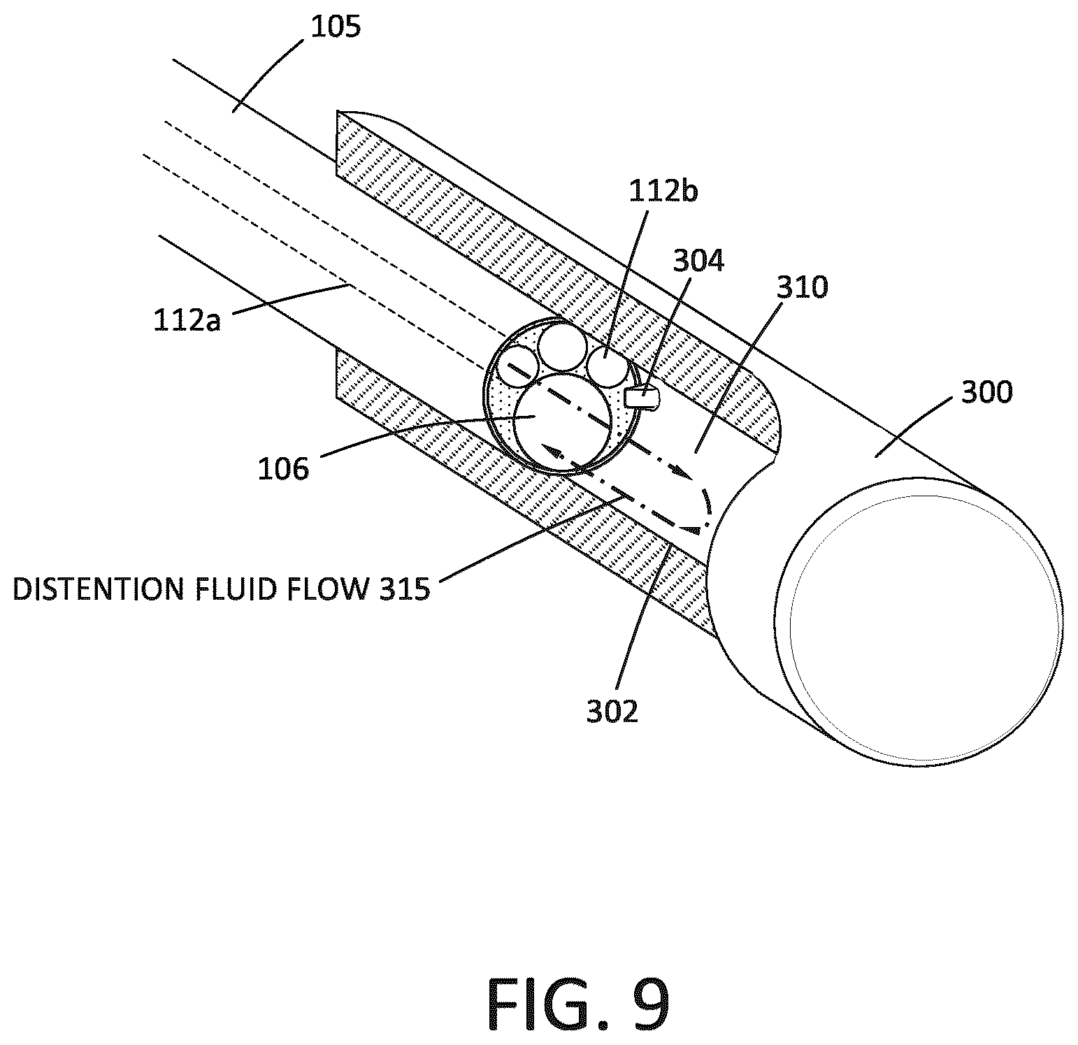 Patent US12324889 Figure 8 – Fluid management system and methods