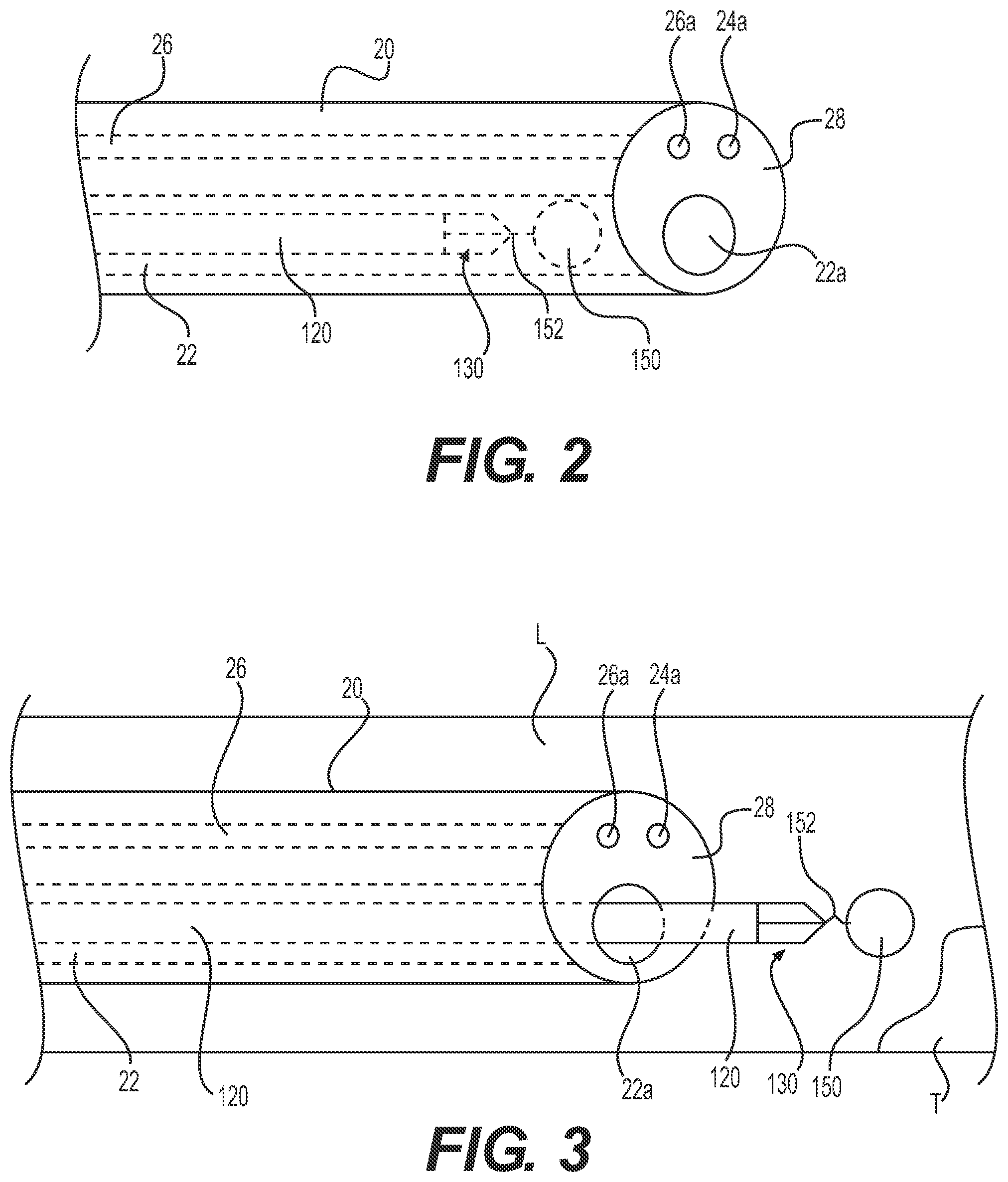 Patent US12324890 Figure 2 – Medical delivery device and method of use