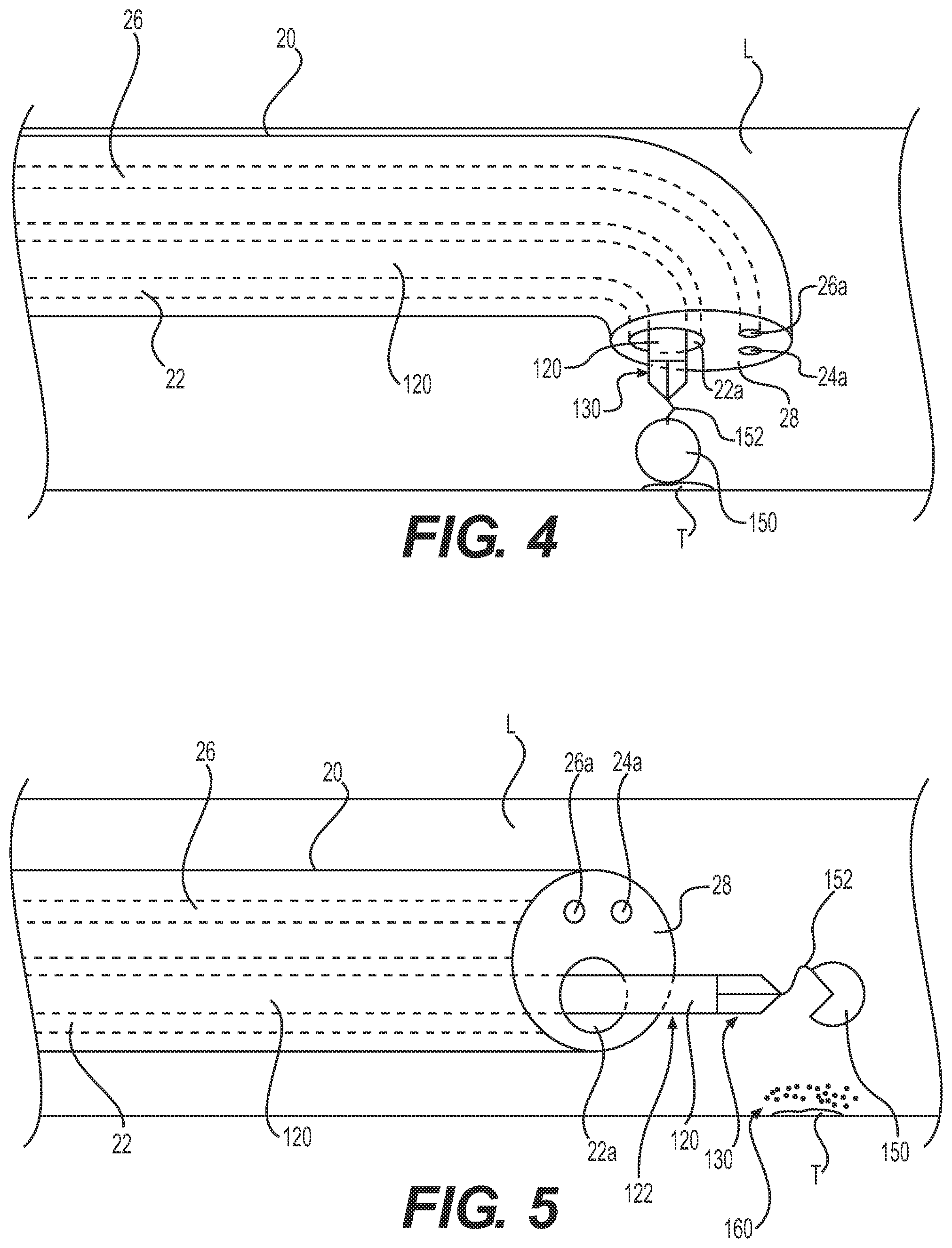 Patent US12324890 Figure 3 – Medical delivery device and method of use