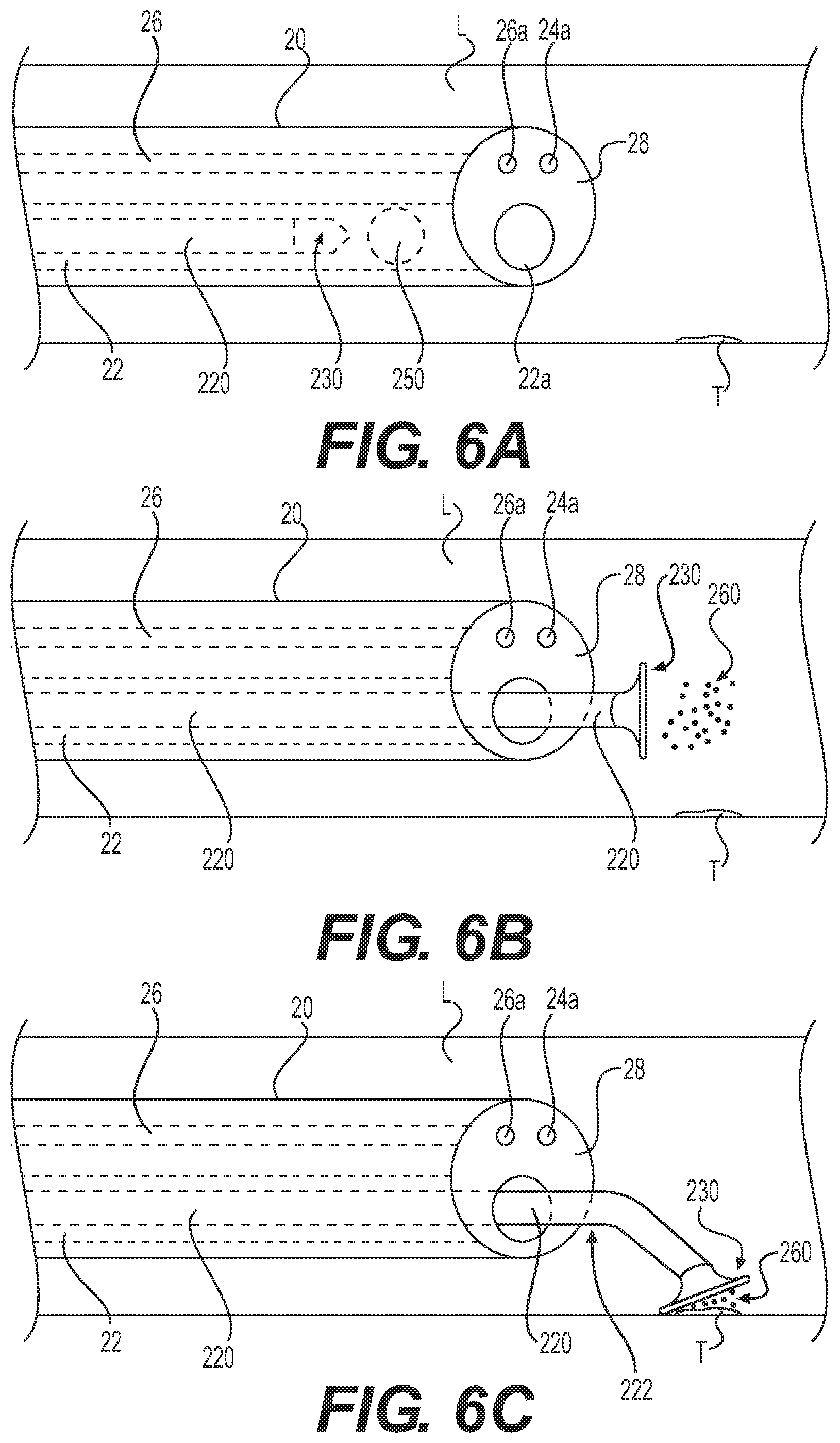 Patent US12324890 Figure 4 – Medical delivery device and method of use