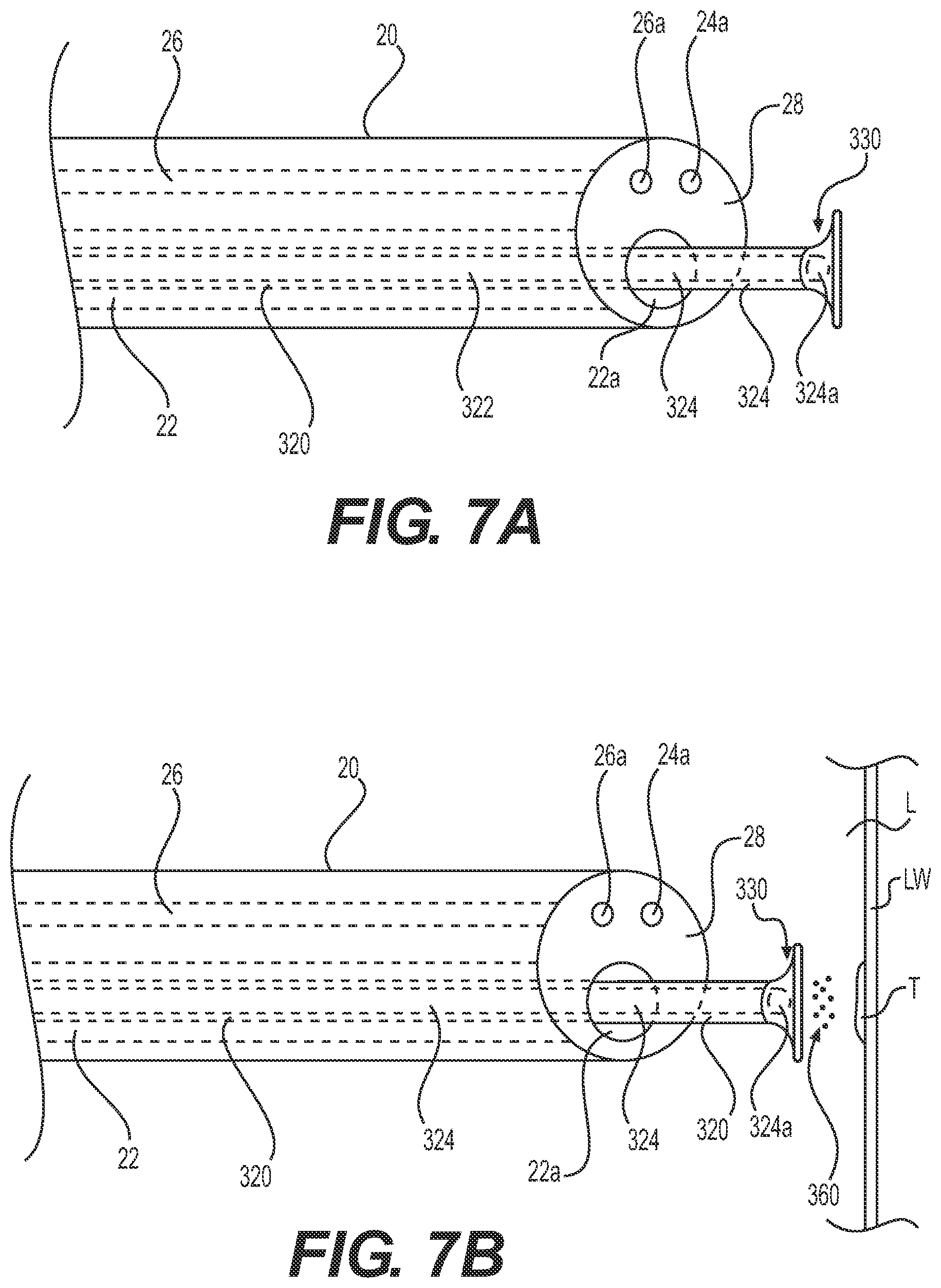 Patent US12324890 Figure 5 – Medical delivery device and method of use