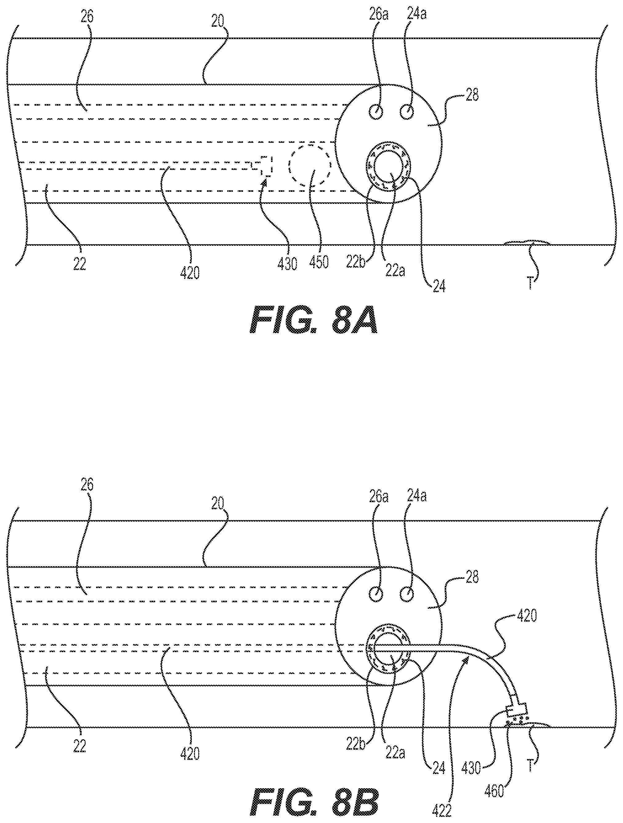 Patent US12324890 Figure 6 – Medical delivery device and method of use