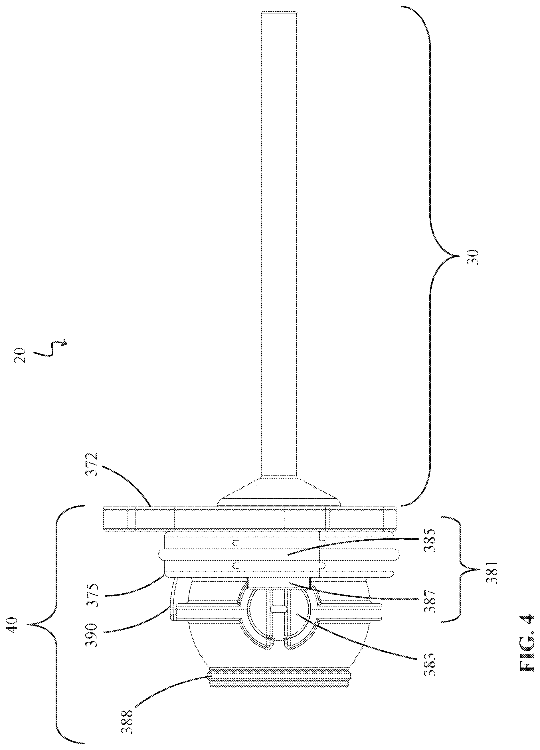 Patent US12324894 Figure 4 – Percutaneous access pathway system
