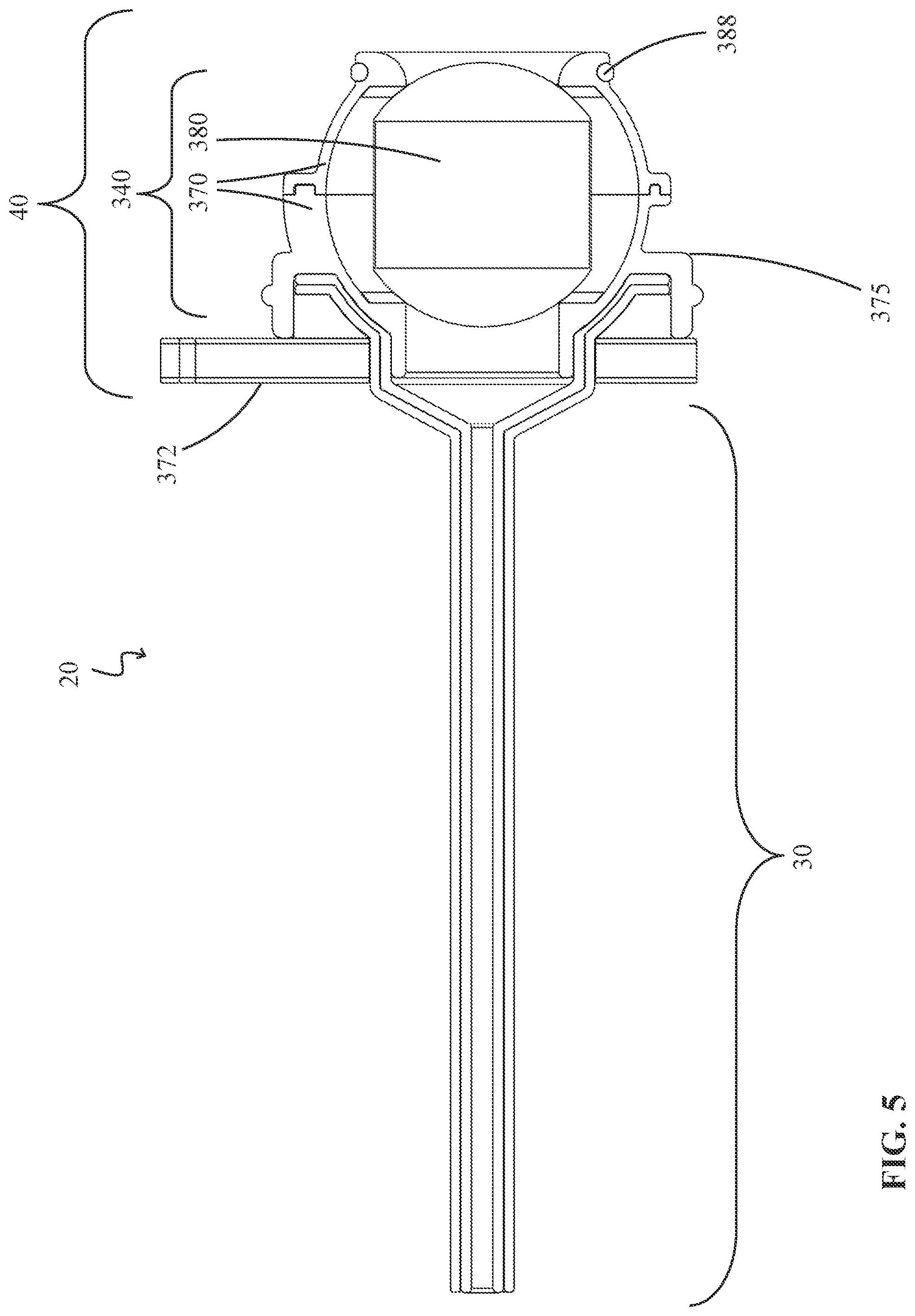 Patent US12324894 Figure 5 – Percutaneous access pathway system