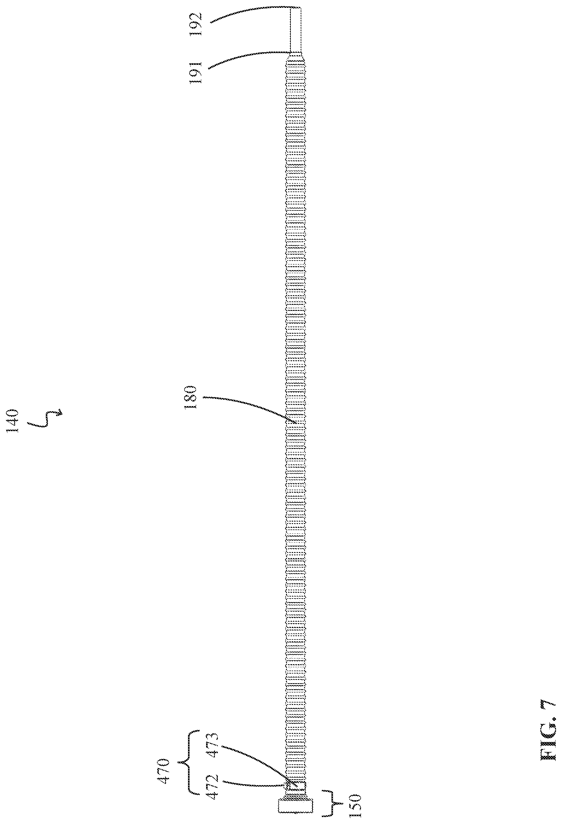 Patent US12324894 Figure 7 – Percutaneous access pathway system