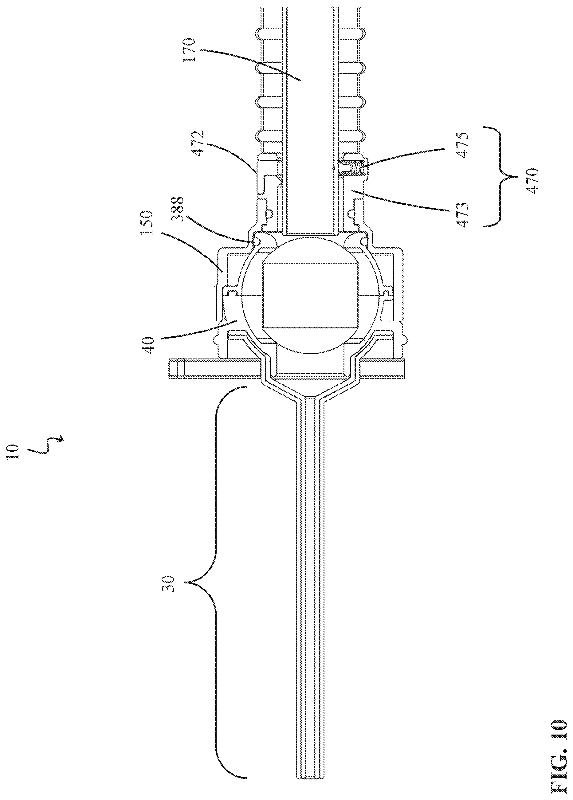 Patent US12324894 Figure 10 – Percutaneous access pathway system