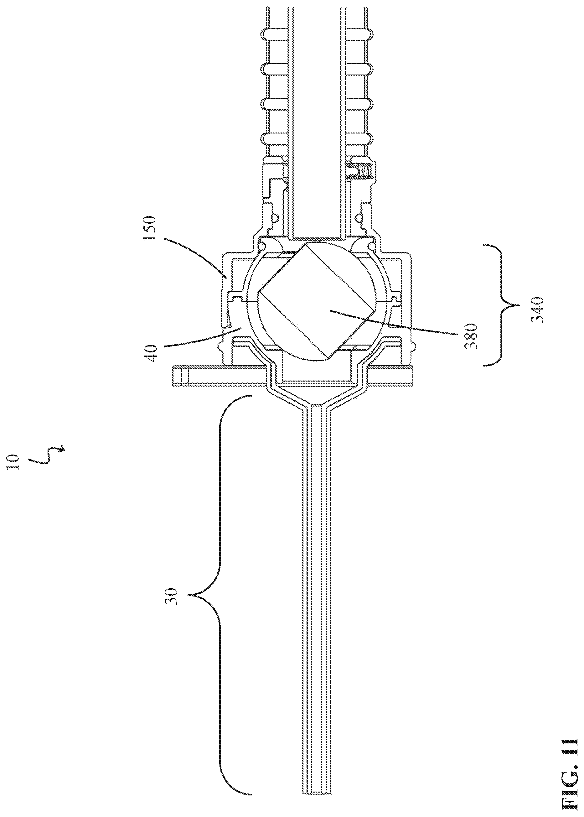 Patent US12324894 Figure 11 – Percutaneous access pathway system