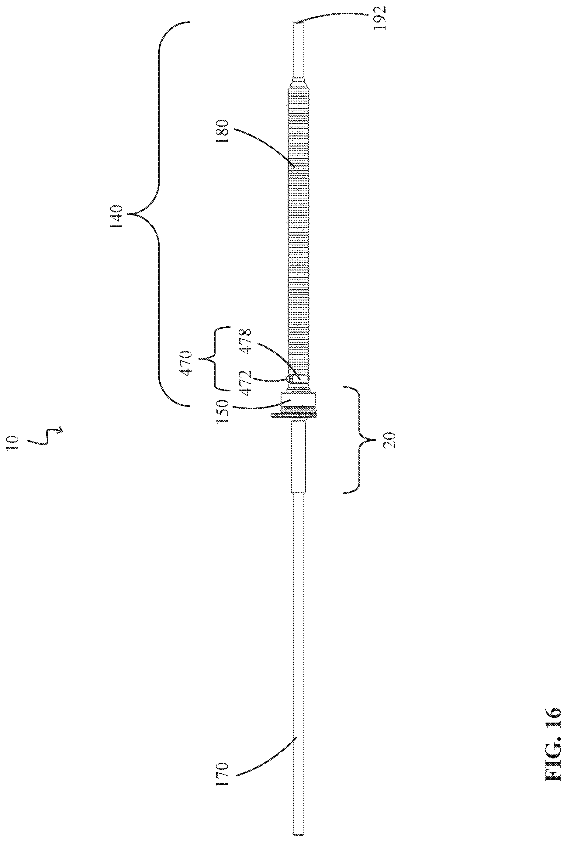 Patent US12324894 Figure 16 – Percutaneous access pathway system