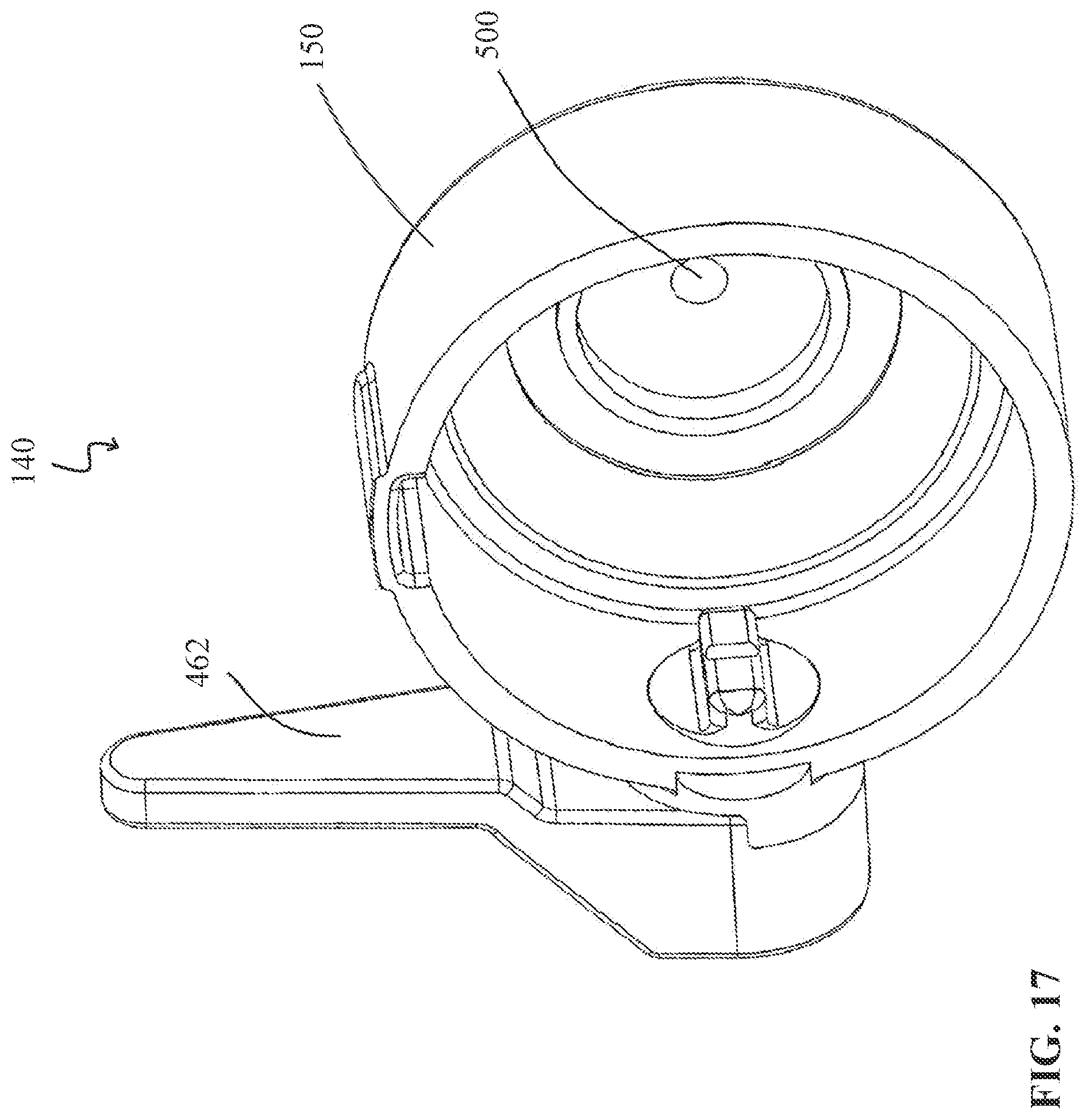 Patent US12324894 Figure 17 – Percutaneous access pathway system