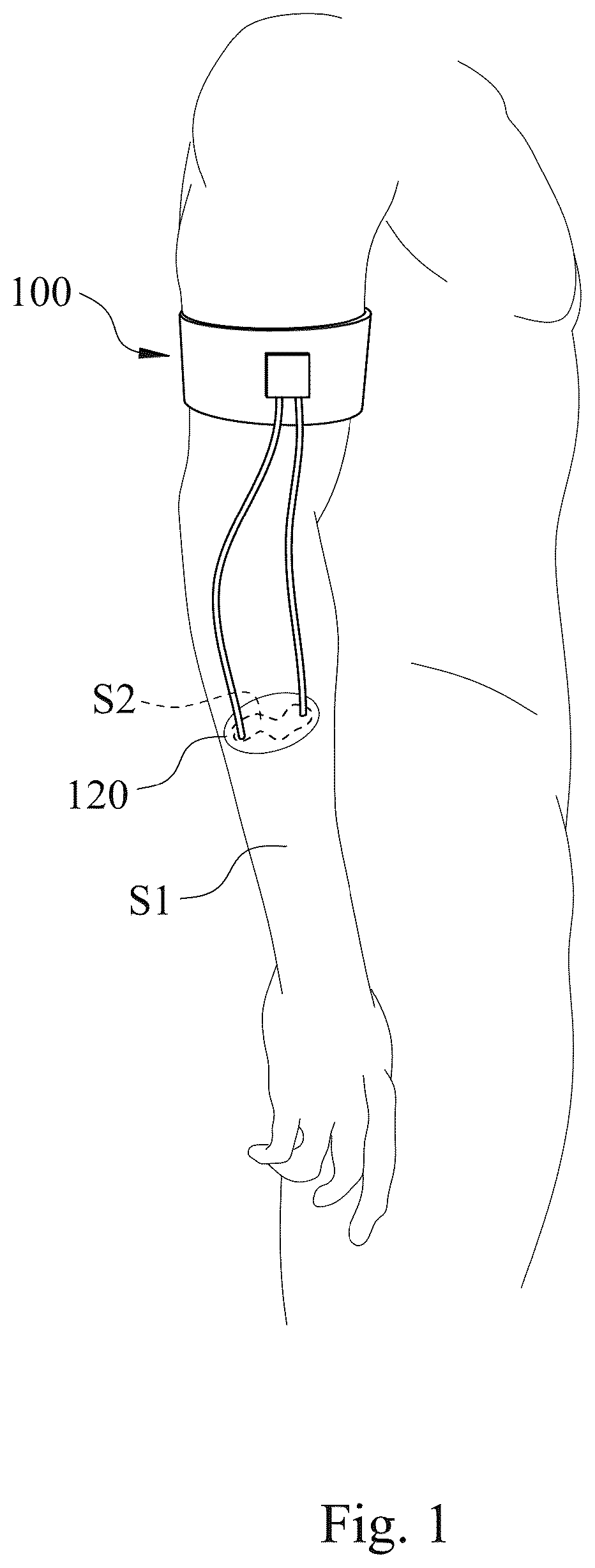Patent US12324908 Figure 1 – Thermoelectric driving wearable system