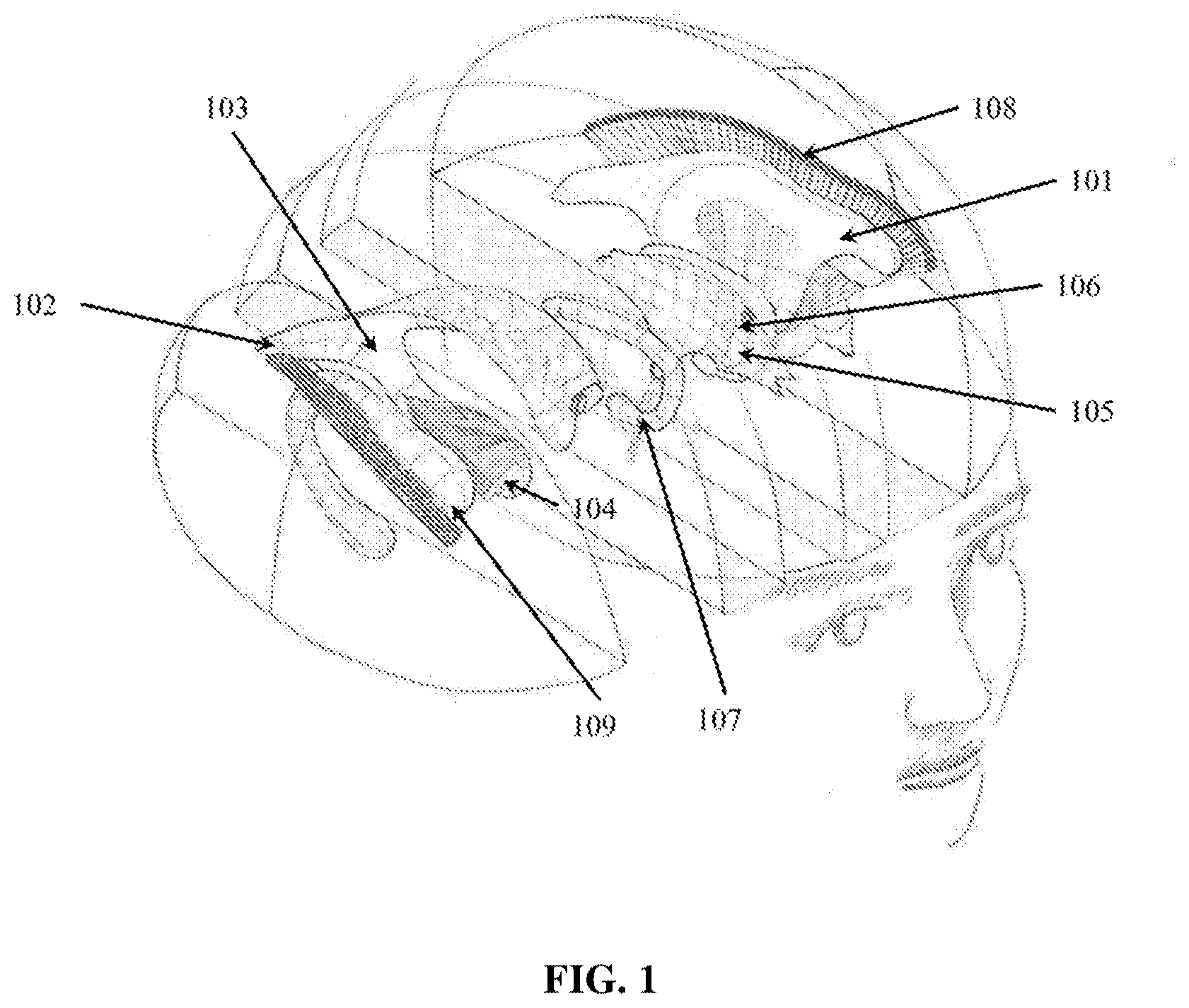 Patent US12324910 Figure 1 – Visual prosthesis employing ventricular or endovascular neural electrode arrays
