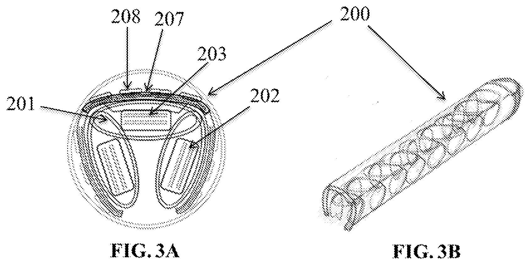 Patent US12324910 Figure 3 – Visual prosthesis employing ventricular or endovascular neural electrode arrays