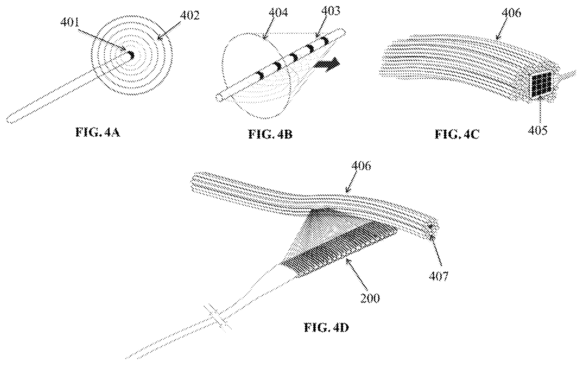 Patent US12324910 Figure 4 – Visual prosthesis employing ventricular or endovascular neural electrode arrays