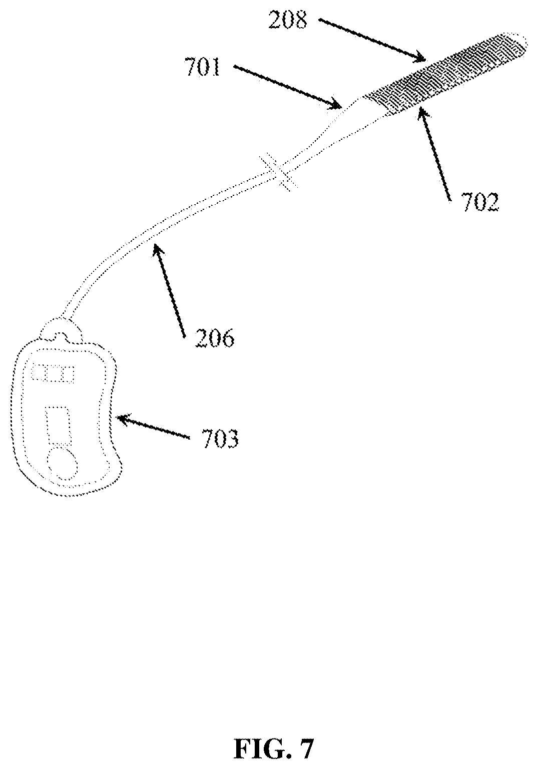 Patent US12324910 Figure 7 – Visual prosthesis employing ventricular or endovascular neural electrode arrays