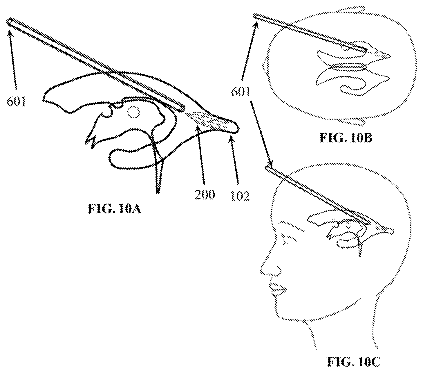 Patent US12324910 Figure 10 – Visual prosthesis employing ventricular or endovascular neural electrode arrays