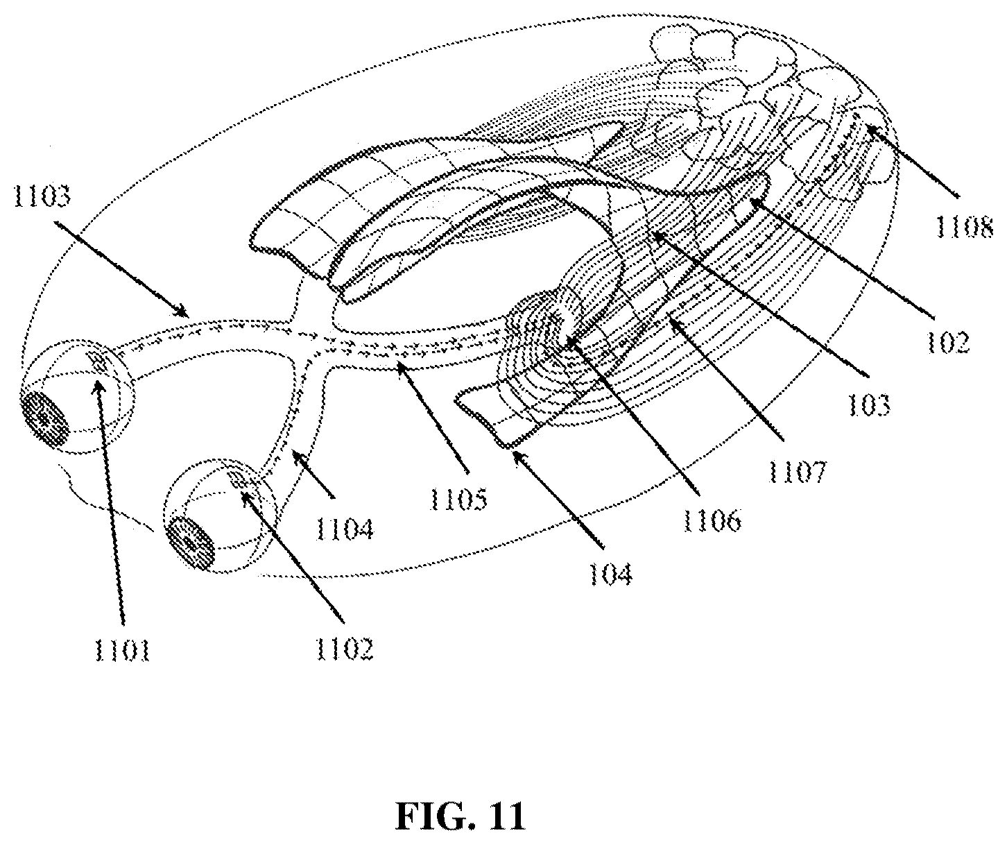 Patent US12324910 Figure 11 – Visual prosthesis employing ventricular or endovascular neural electrode arrays