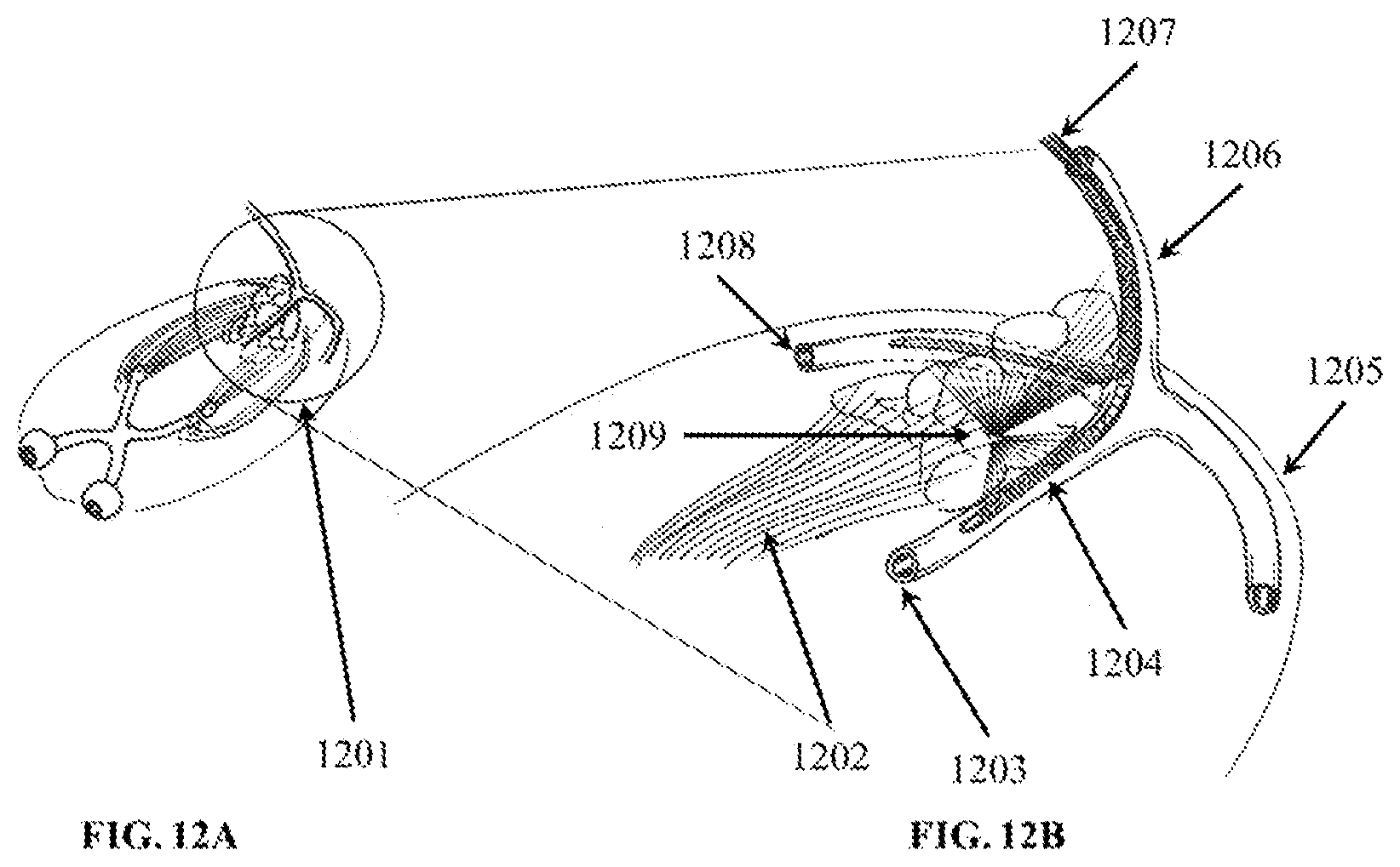 Patent US12324910 Figure 12 – Visual prosthesis employing ventricular or endovascular neural electrode arrays