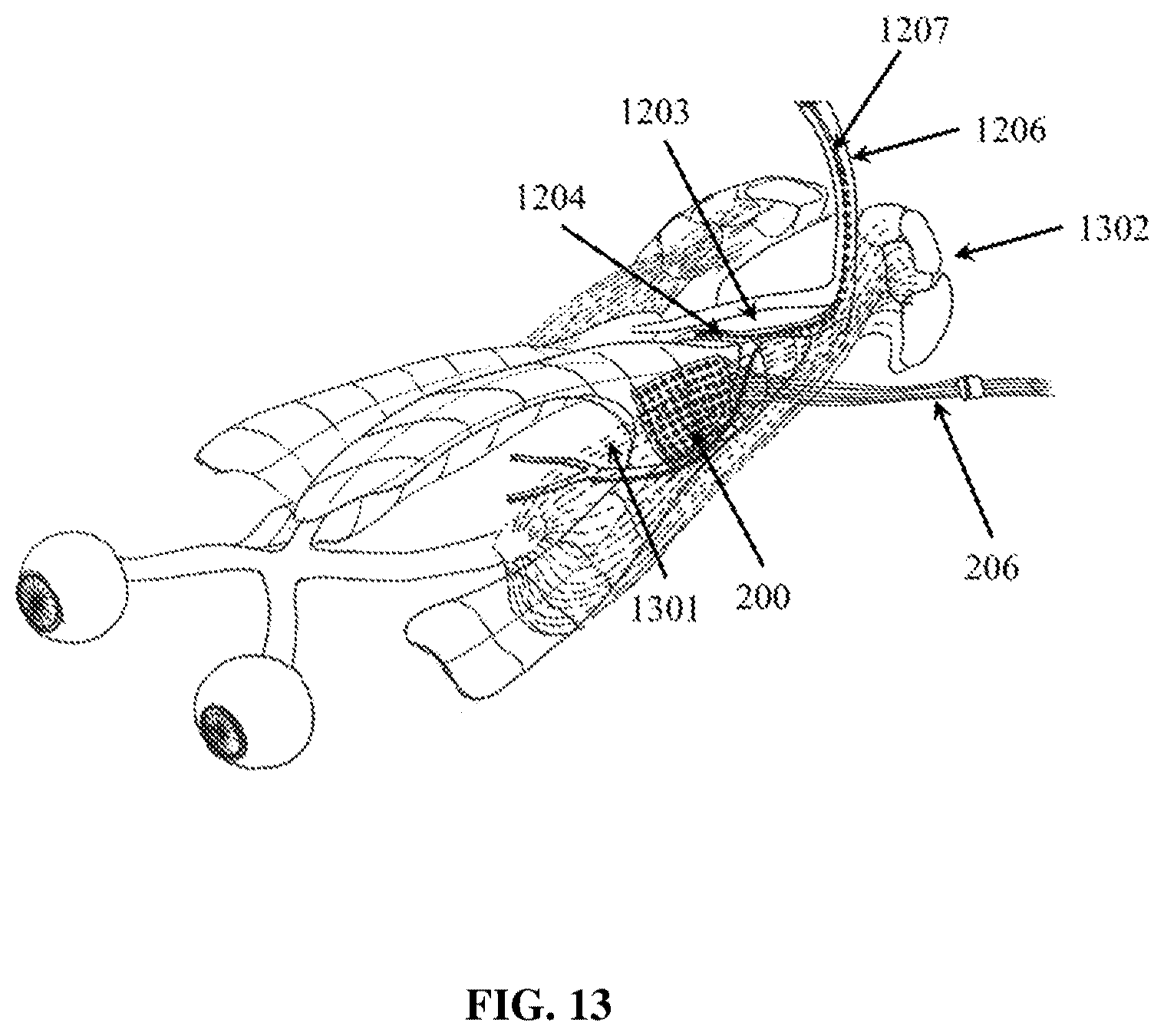 Patent US12324910 Figure 13 – Visual prosthesis employing ventricular or endovascular neural electrode arrays