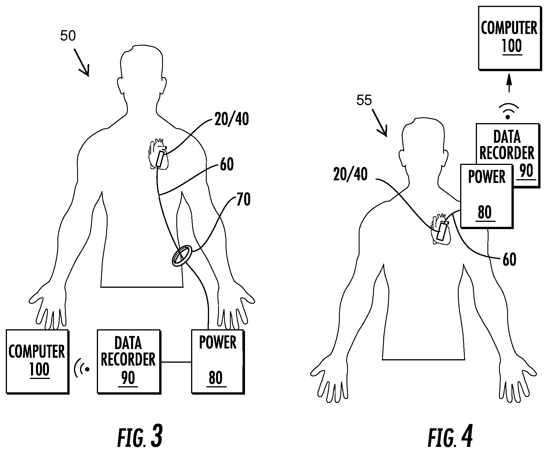 Patent US12324912 Figure 2 – Devices, systems, and methods for treating cardiac arrhythmias