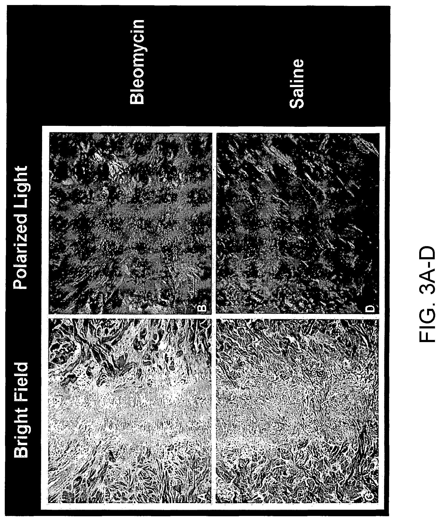 Patent US12324913 Figure 3 – Method and device for treating microscopic residual tumors remaining in tissues following surgical resection