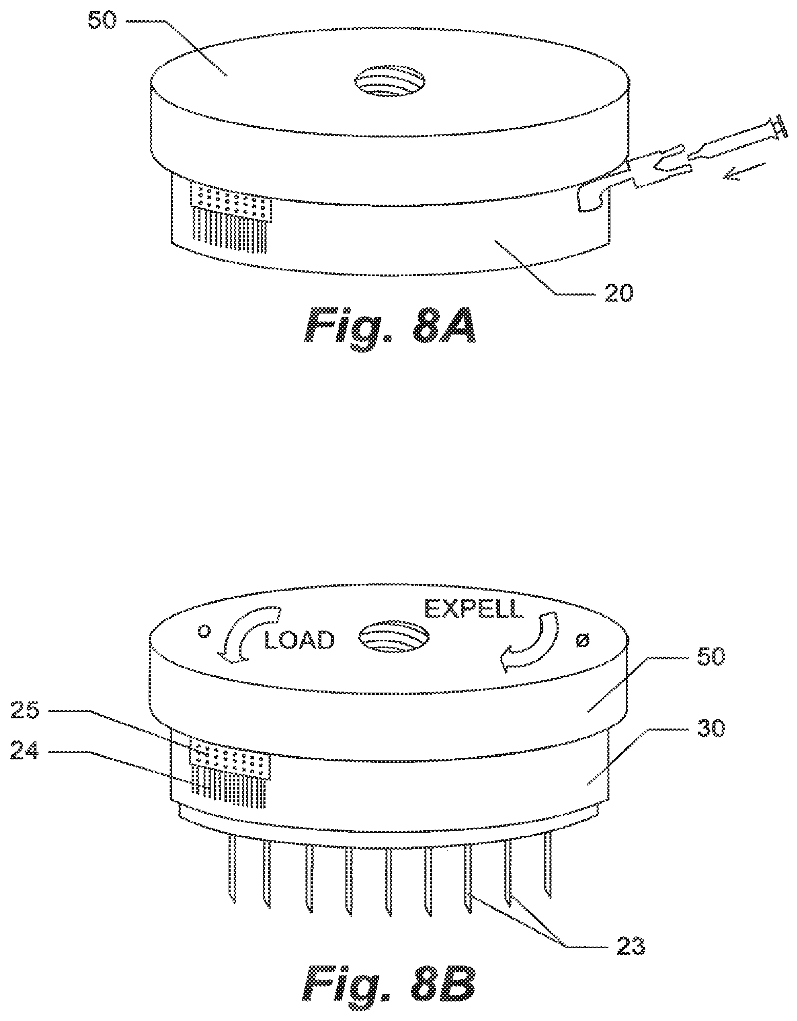 Patent US12324913 Figure 8 – Method and device for treating microscopic residual tumors remaining in tissues following surgical resection