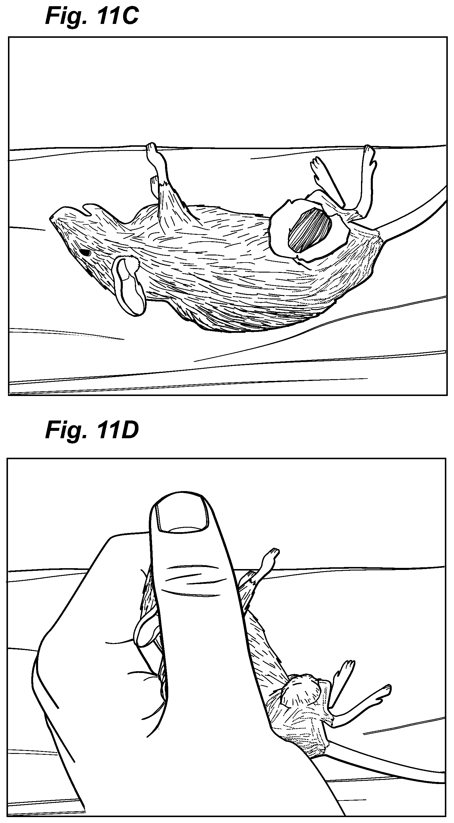 Patent US12324913 Figure 11 – Method and device for treating microscopic residual tumors remaining in tissues following surgical resection