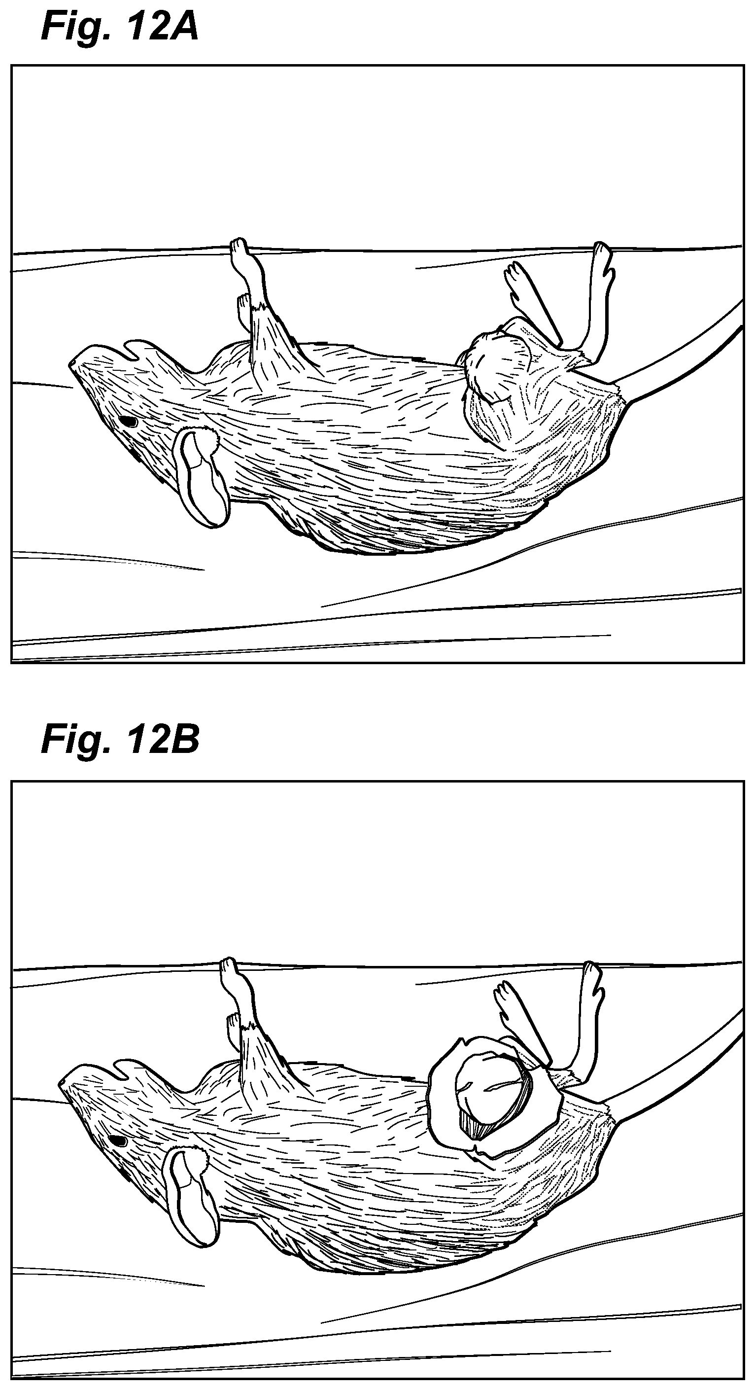 Patent US12324913 Figure 12 – Method and device for treating microscopic residual tumors remaining in tissues following surgical resection