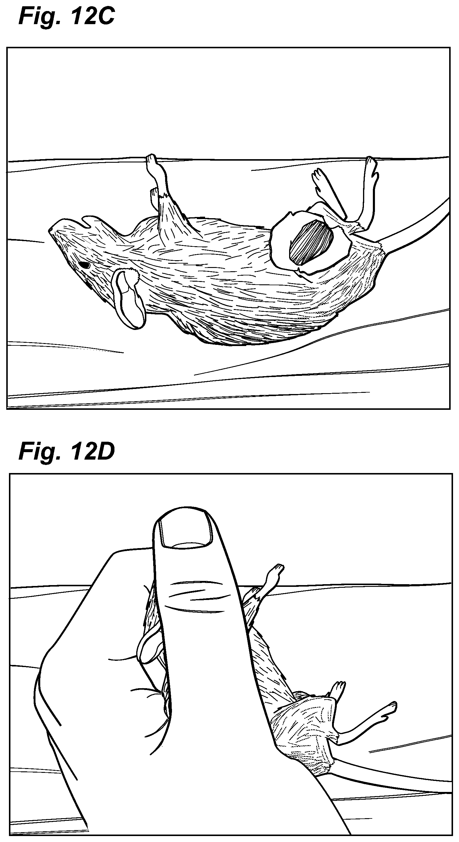 Patent US12324913 Figure 13 – Method and device for treating microscopic residual tumors remaining in tissues following surgical resection
