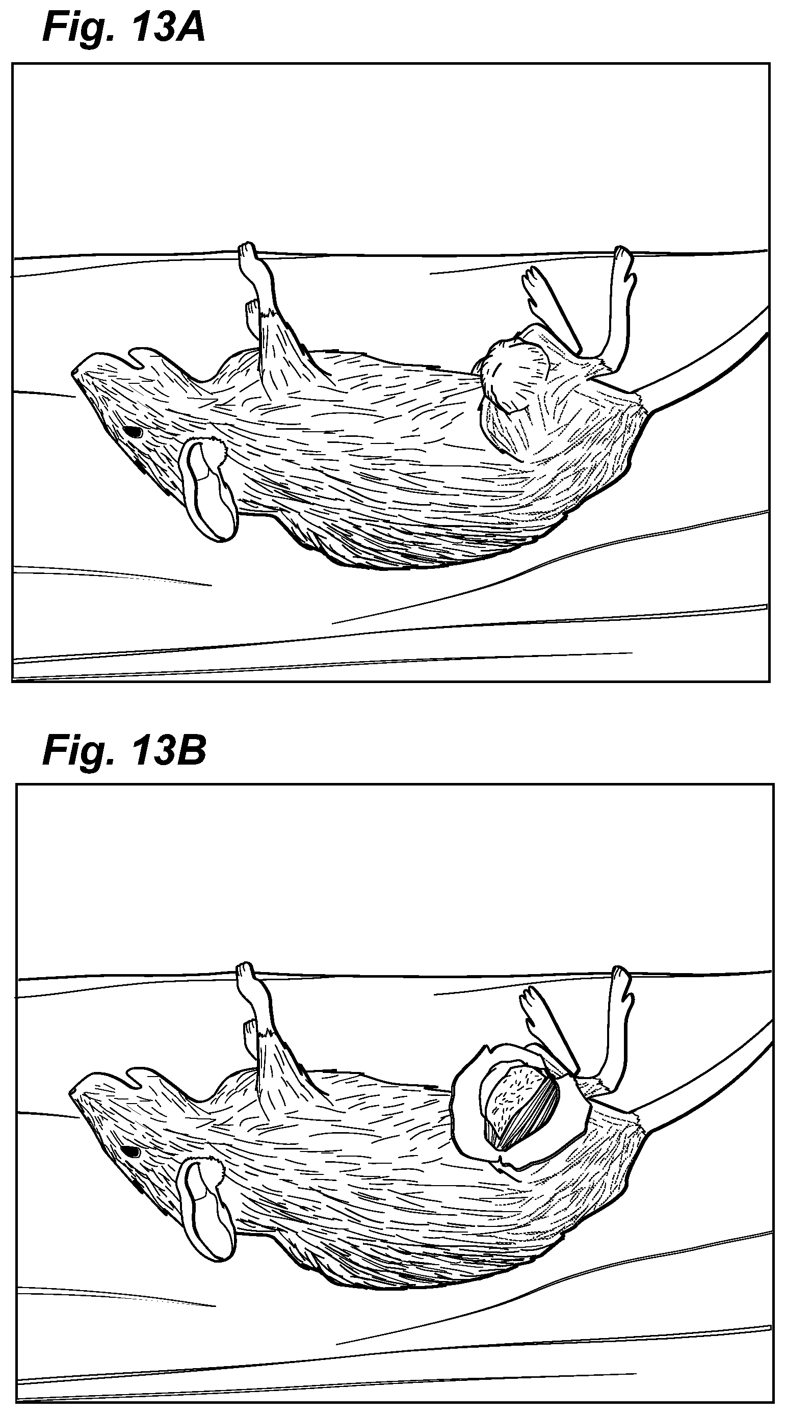 Patent US12324913 Figure 14 – Method and device for treating microscopic residual tumors remaining in tissues following surgical resection