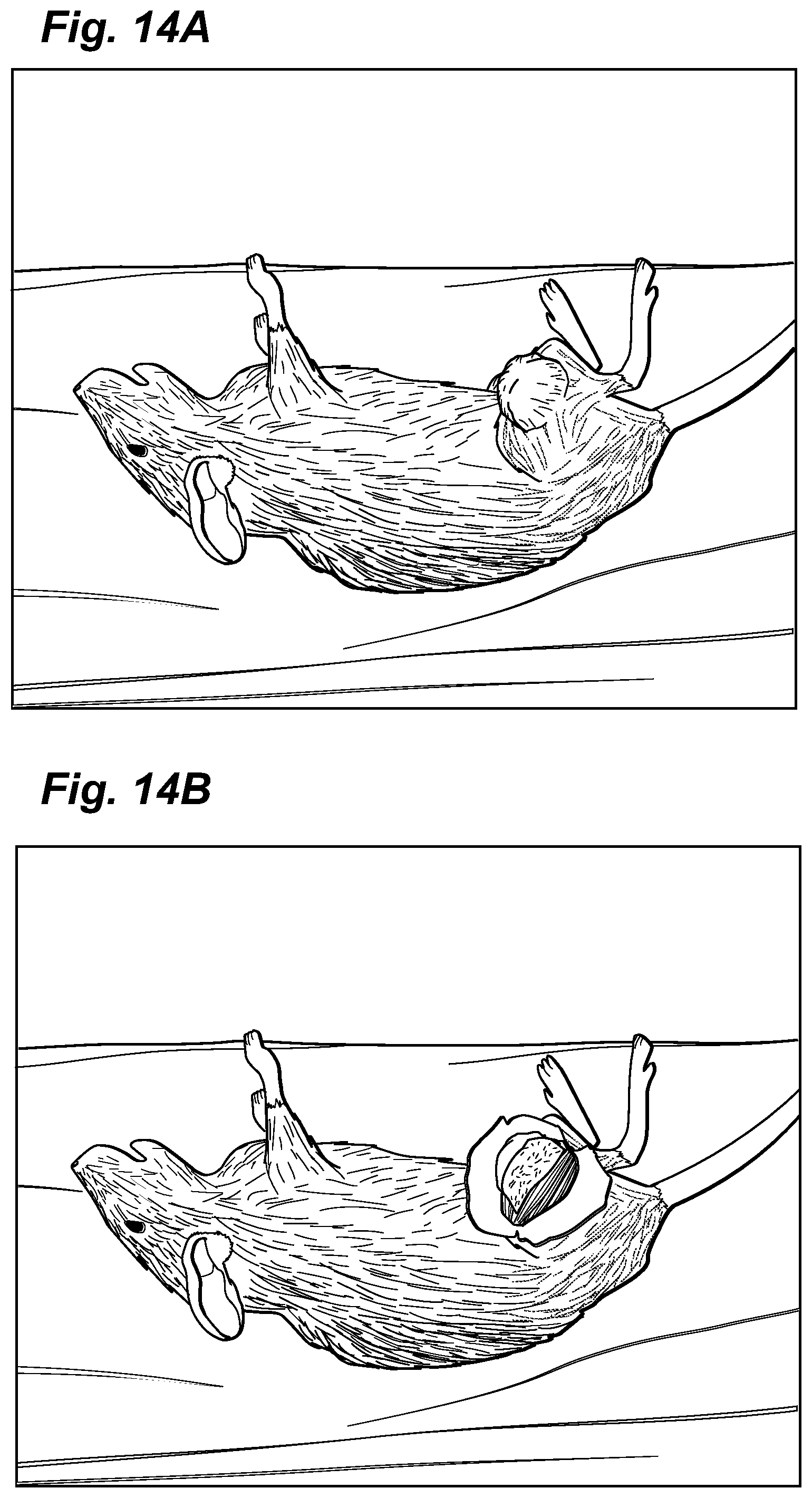 Patent US12324913 Figure 16 – Method and device for treating microscopic residual tumors remaining in tissues following surgical resection