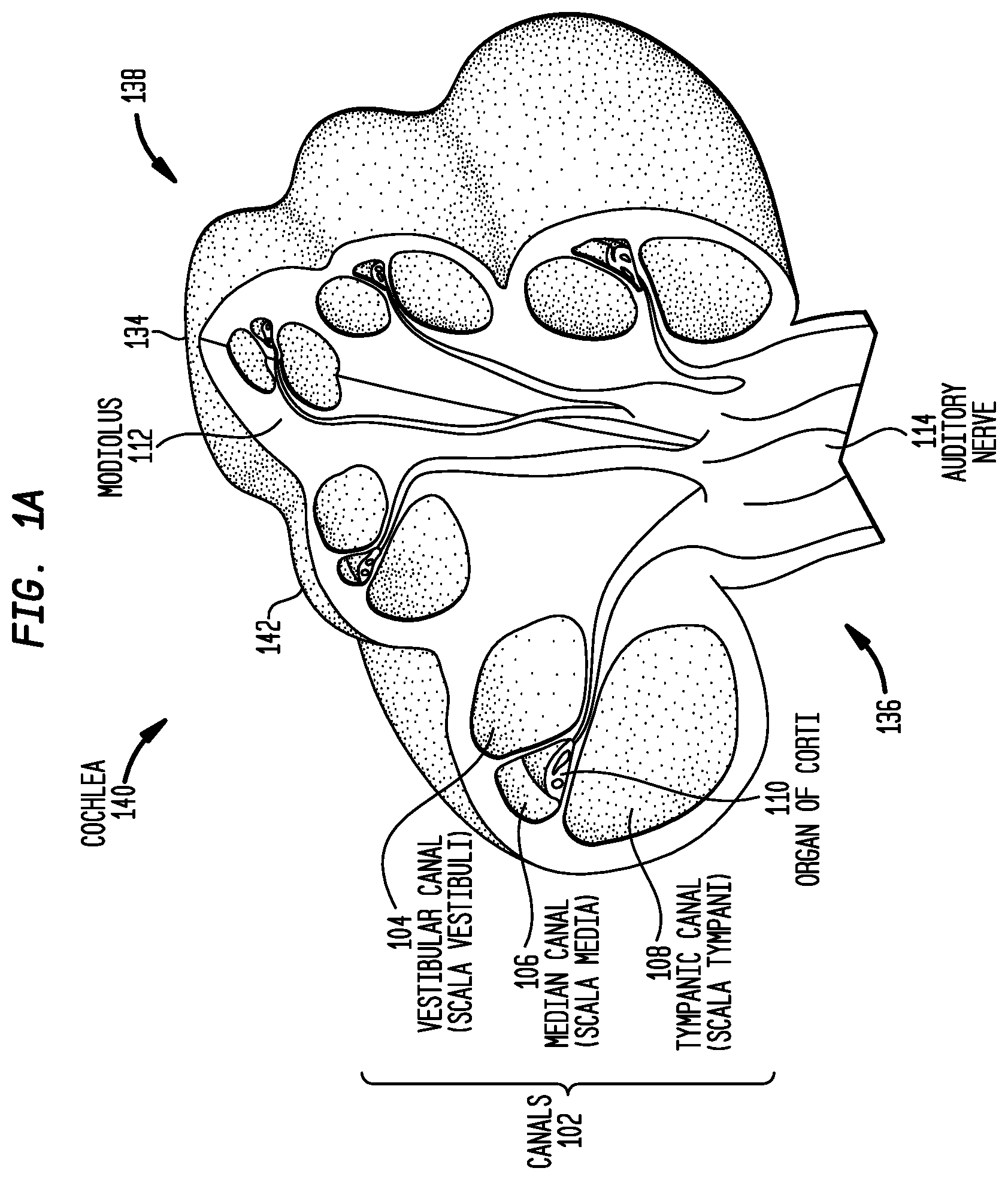 Patent US12324915 Figure 1 – Inner ear electrode implantation outcome assessment