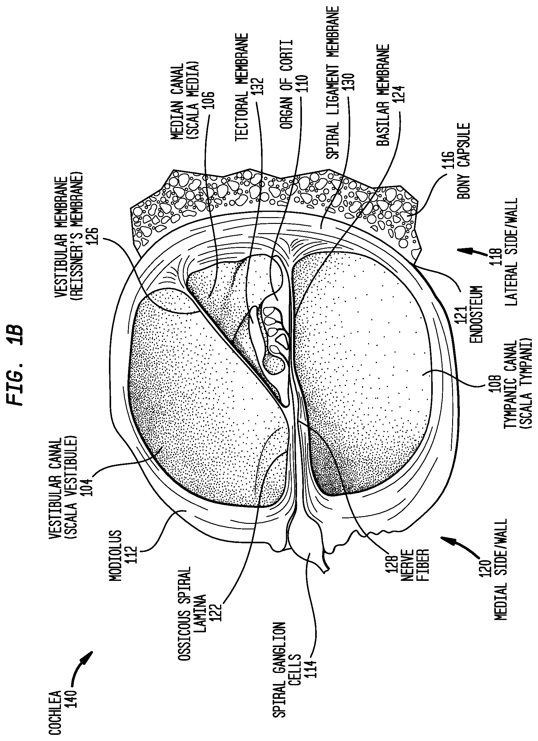 Patent US12324915 Figure 2 – Inner ear electrode implantation outcome assessment