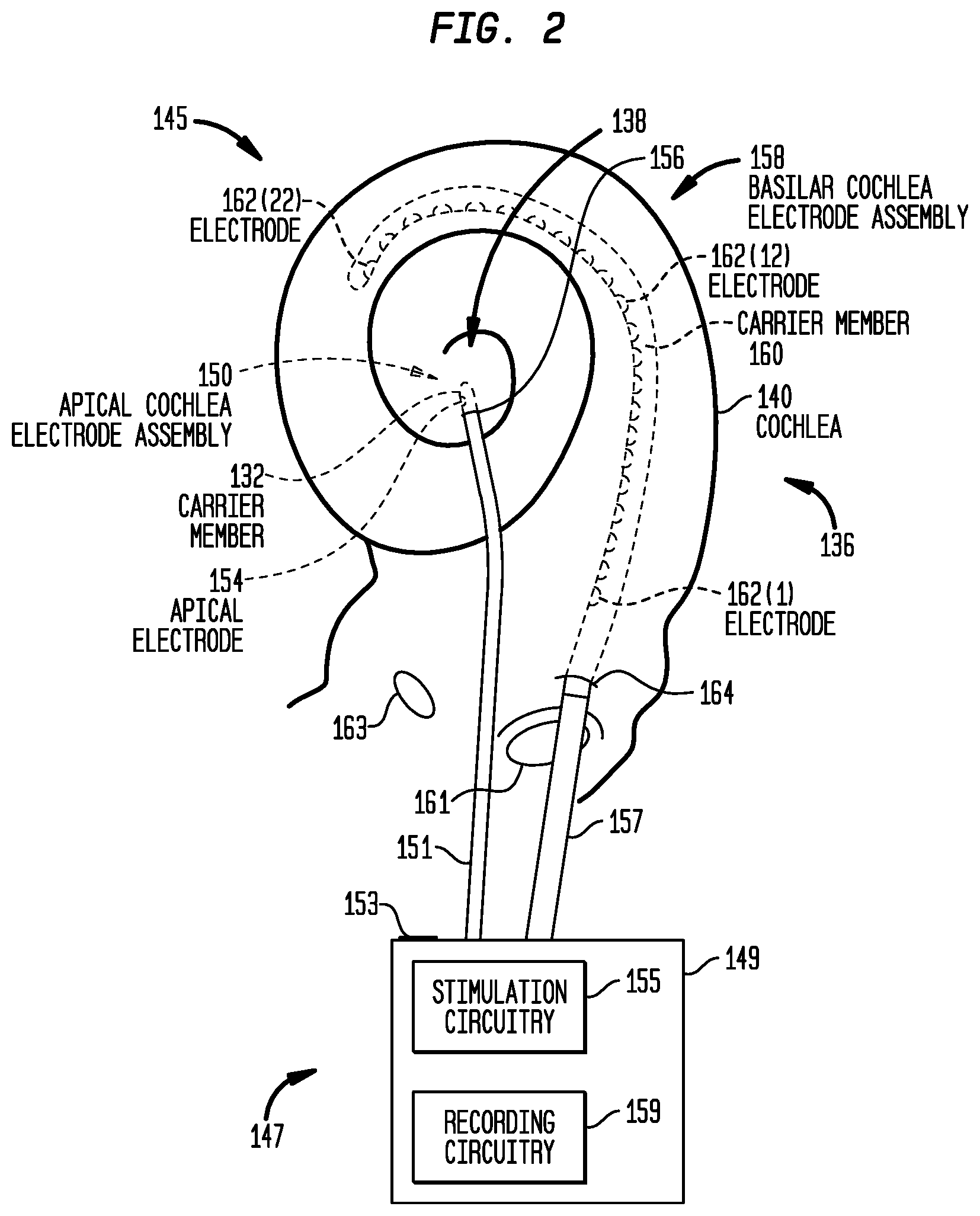 Patent US12324915 Figure 3 – Inner ear electrode implantation outcome assessment