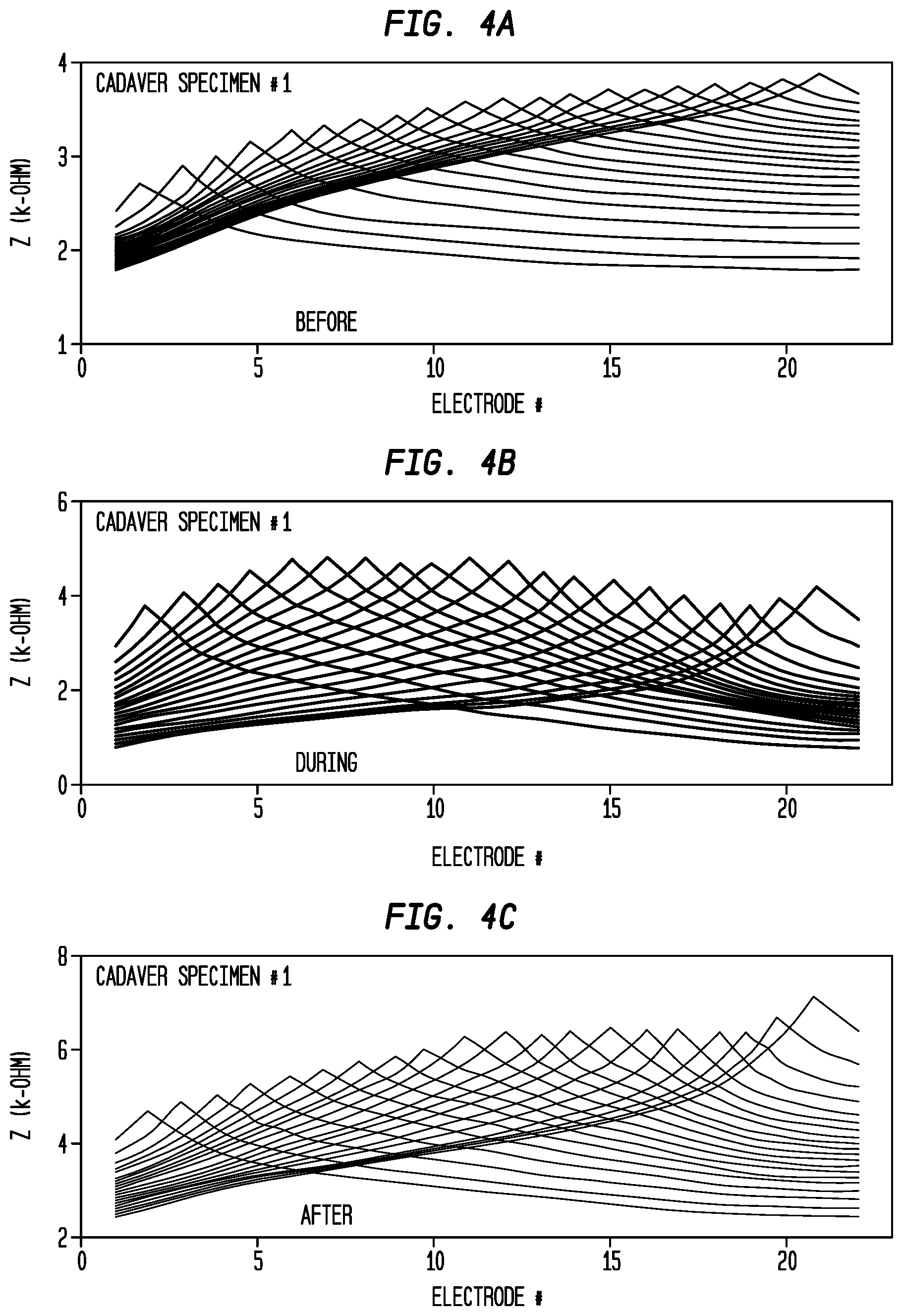 Patent US12324915 Figure 5 – Inner ear electrode implantation outcome assessment