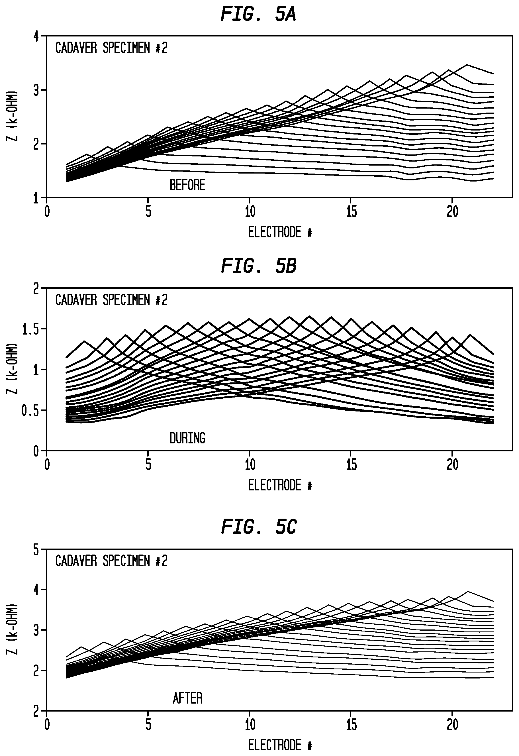 Patent US12324915 Figure 6 – Inner ear electrode implantation outcome assessment