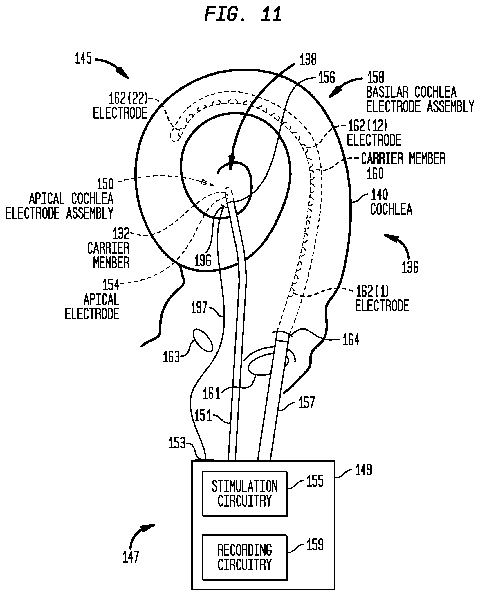 Patent US12324915 Figure 13 – Inner ear electrode implantation outcome assessment