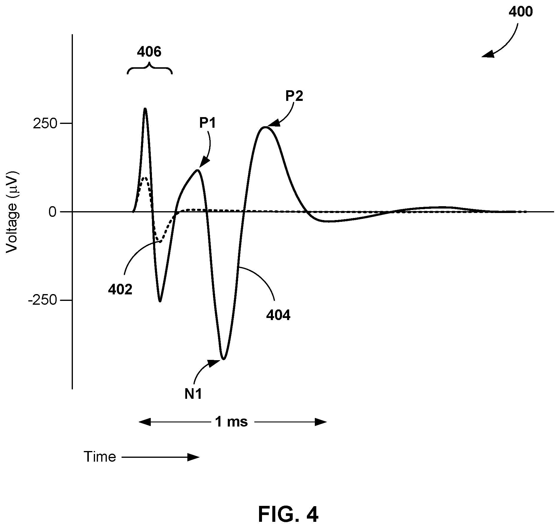 Patent US12324916 Figure 4 – Hybrid control policy for ECAP-servoed neuromodulation