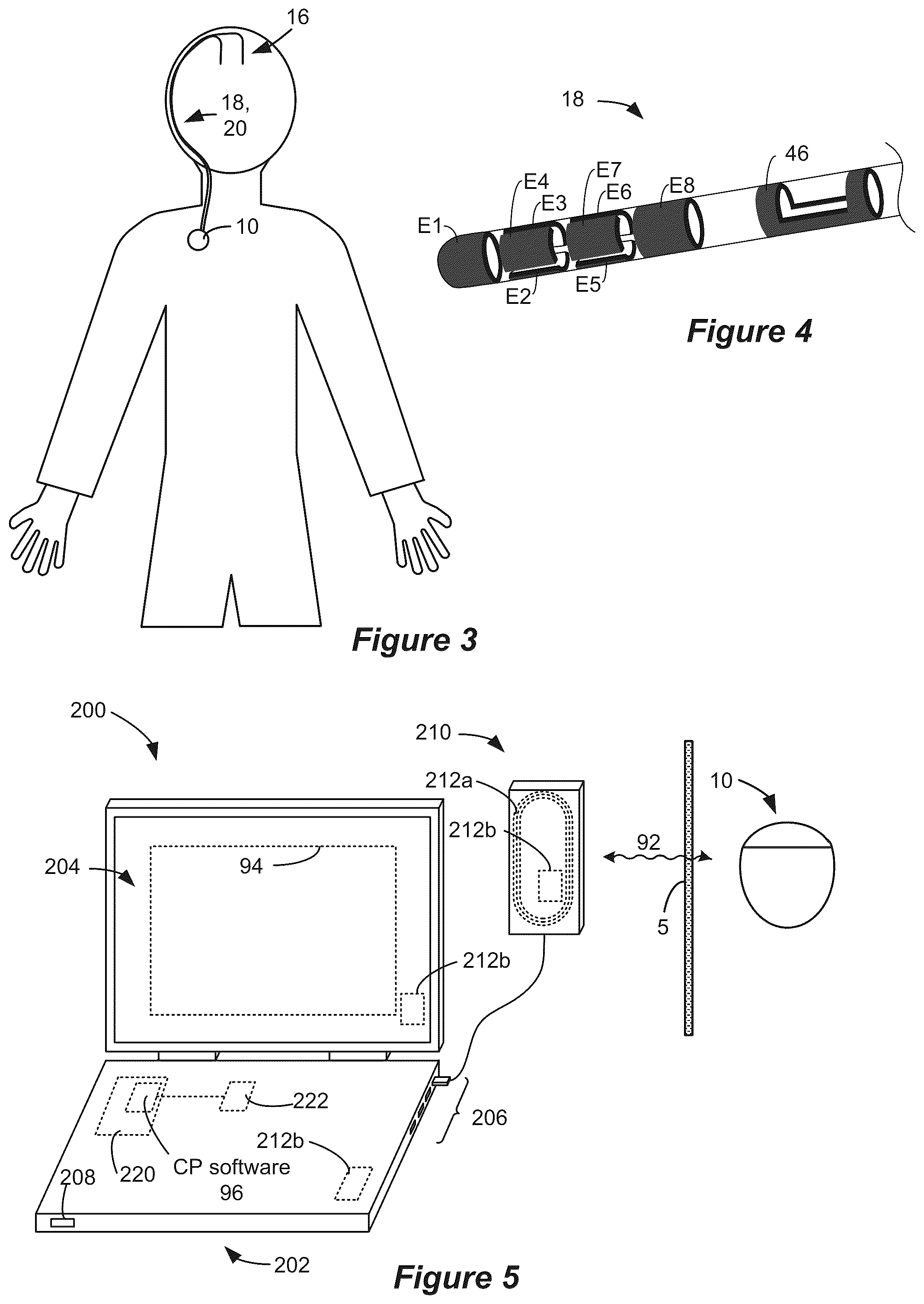Patent US12324917 Figure 2 – System to optimize anodic stimulation modes
