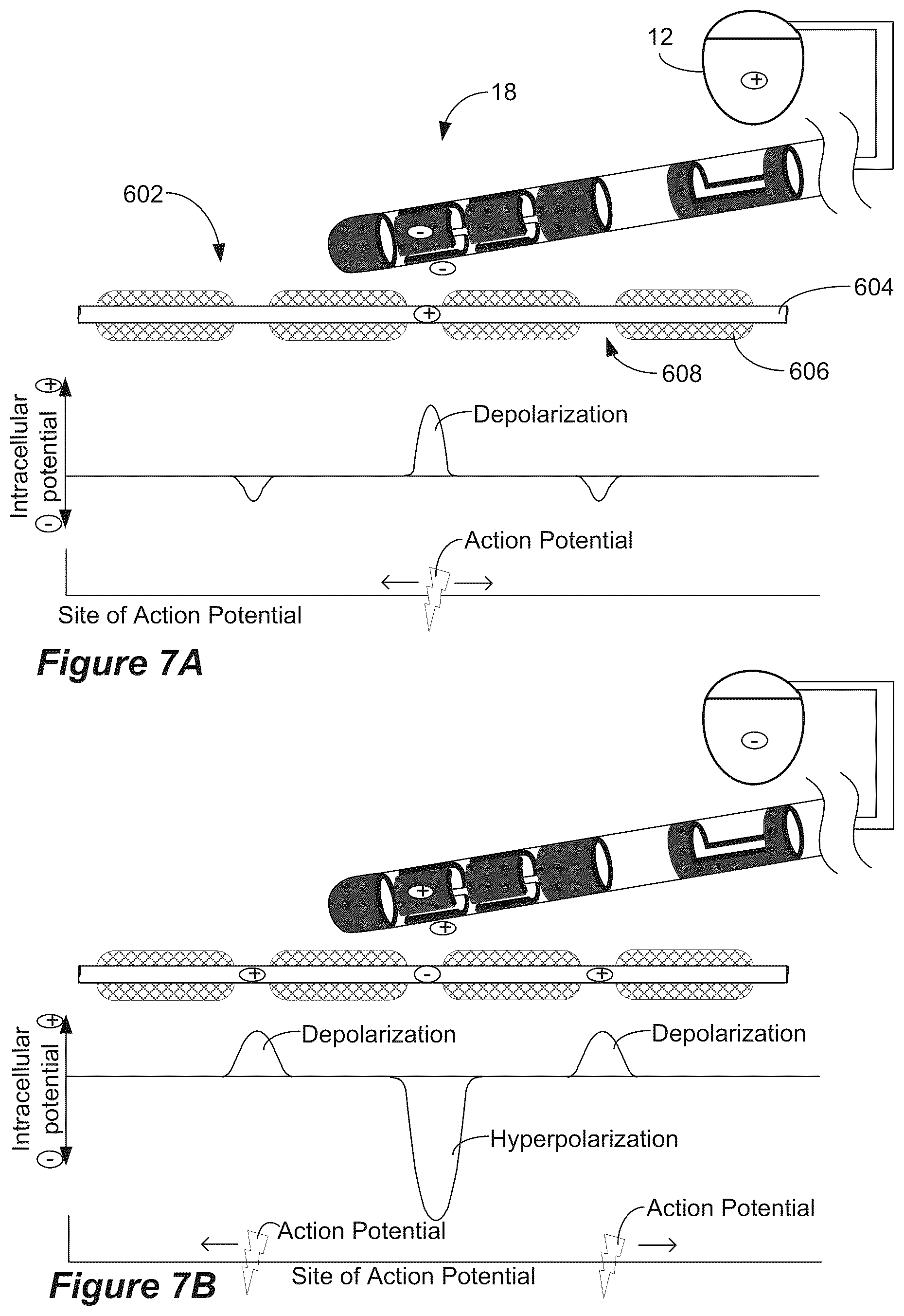 Patent US12324917 Figure 4 – System to optimize anodic stimulation modes