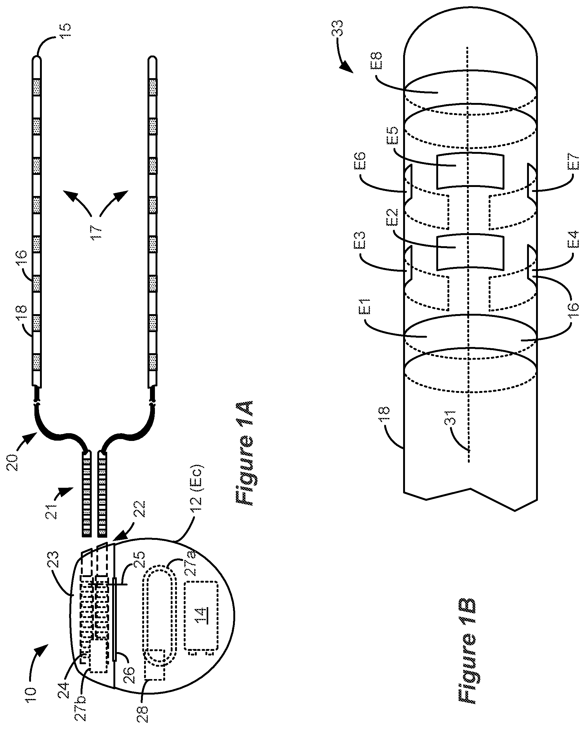 Patent US12324918 — Methods and systems for lead movement detection and response in DBS therapy — Figure 1