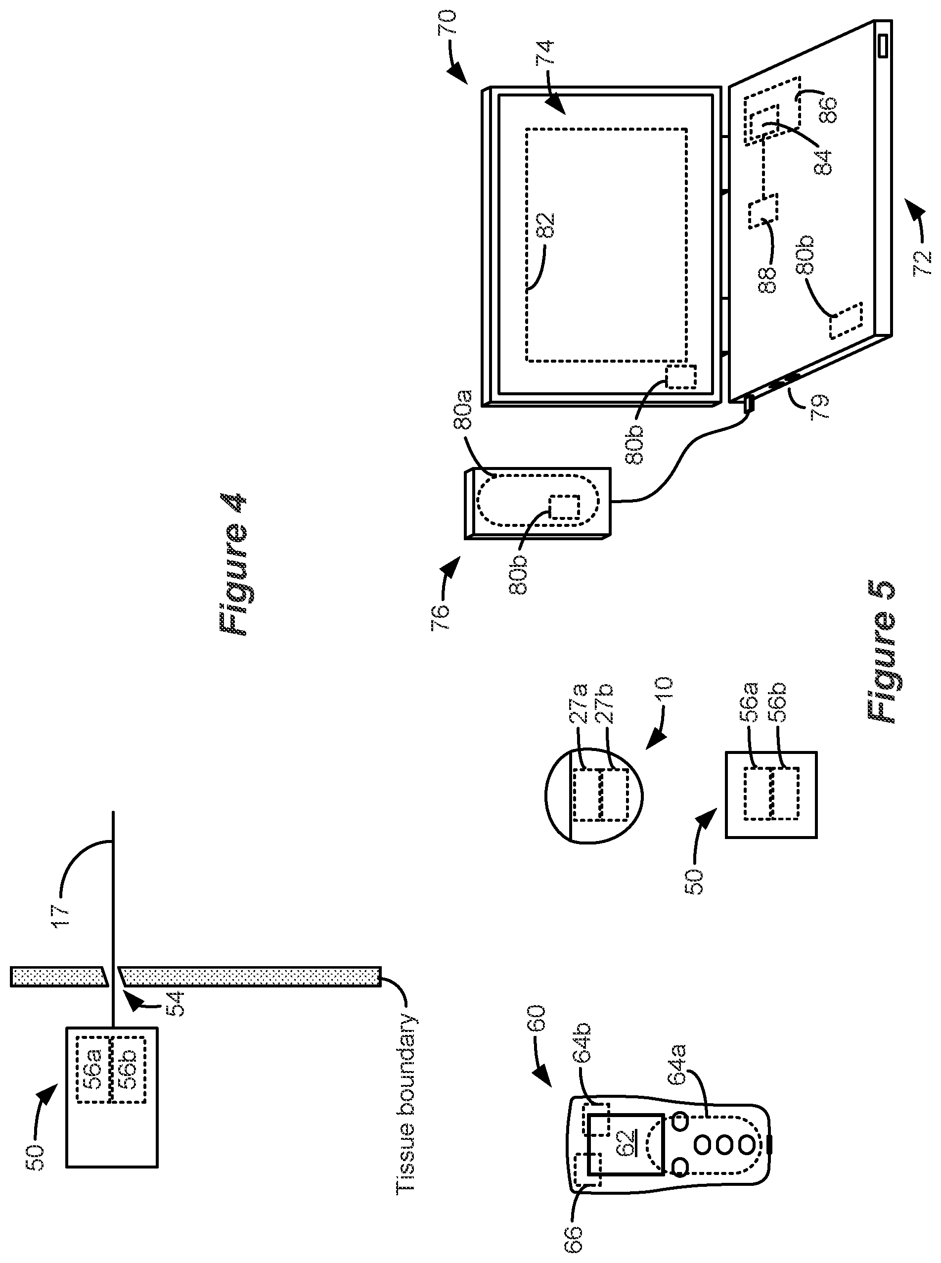 Patent US12324918 Figure 3 – Methods and systems for lead movement detection and response in DBS therapy