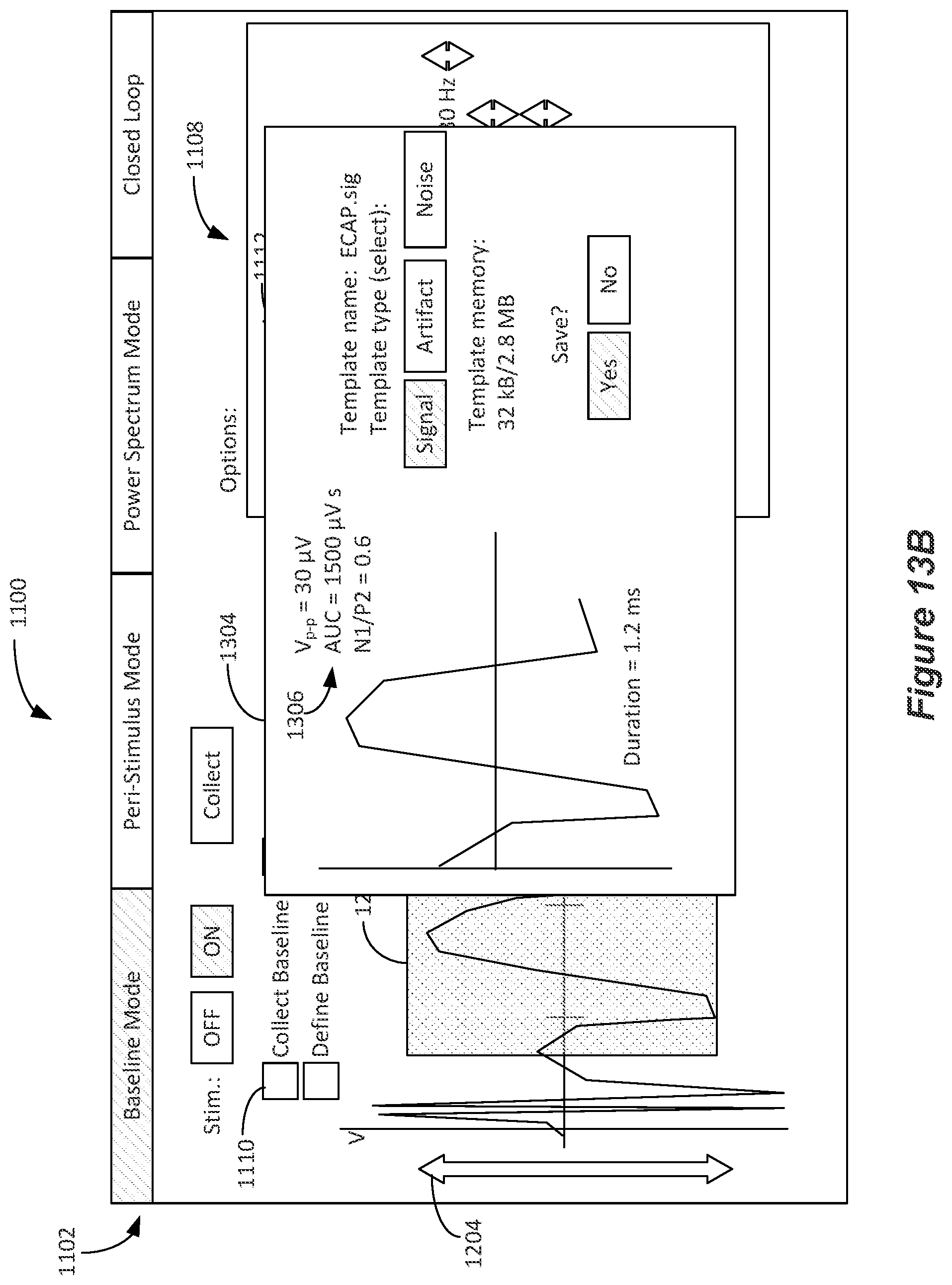 Patent US12324918 Figure 11 – Methods and systems for lead movement detection and response in DBS therapy