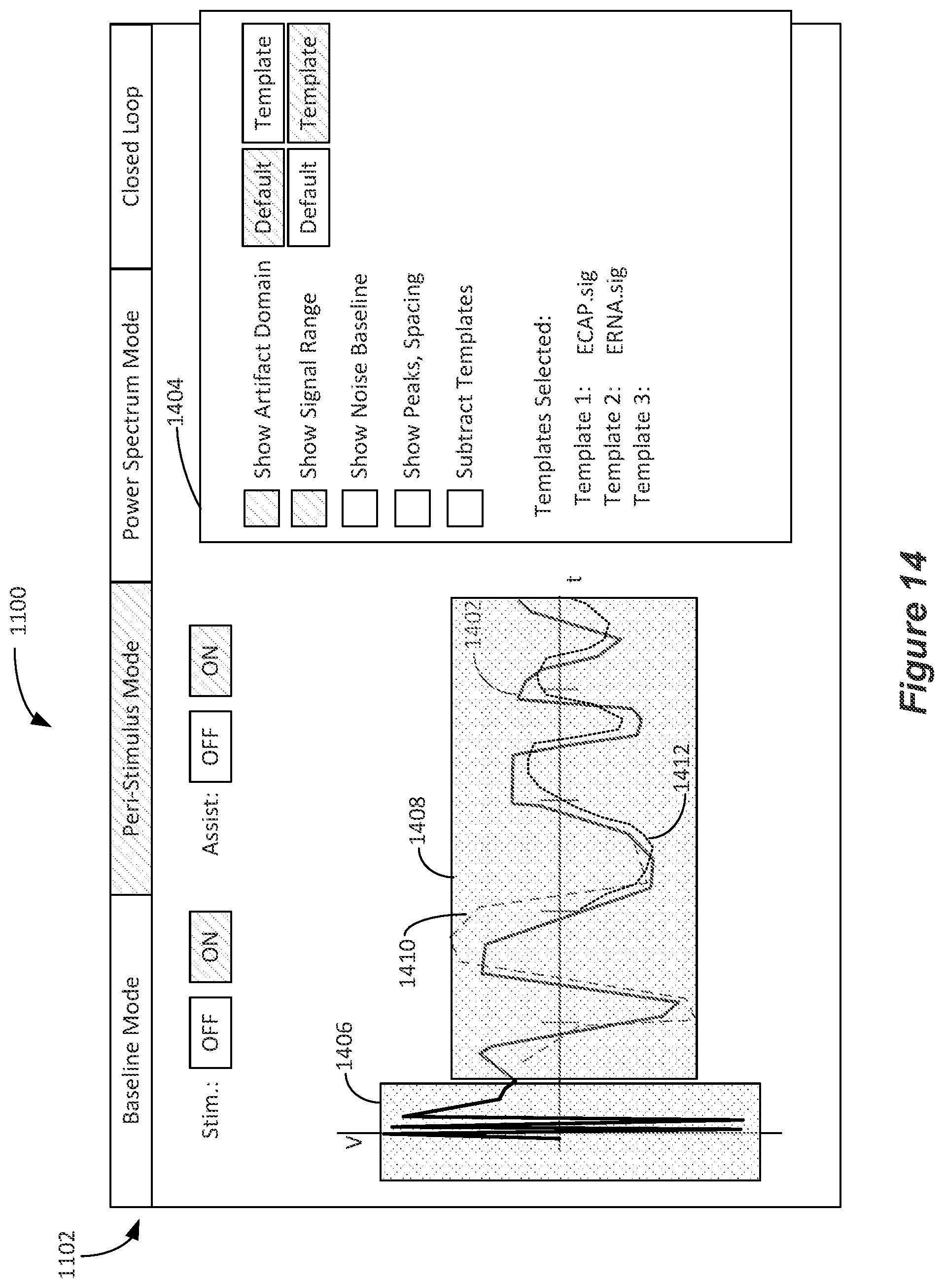 Patent US12324918 Figure 12 – Methods and systems for lead movement detection and response in DBS therapy