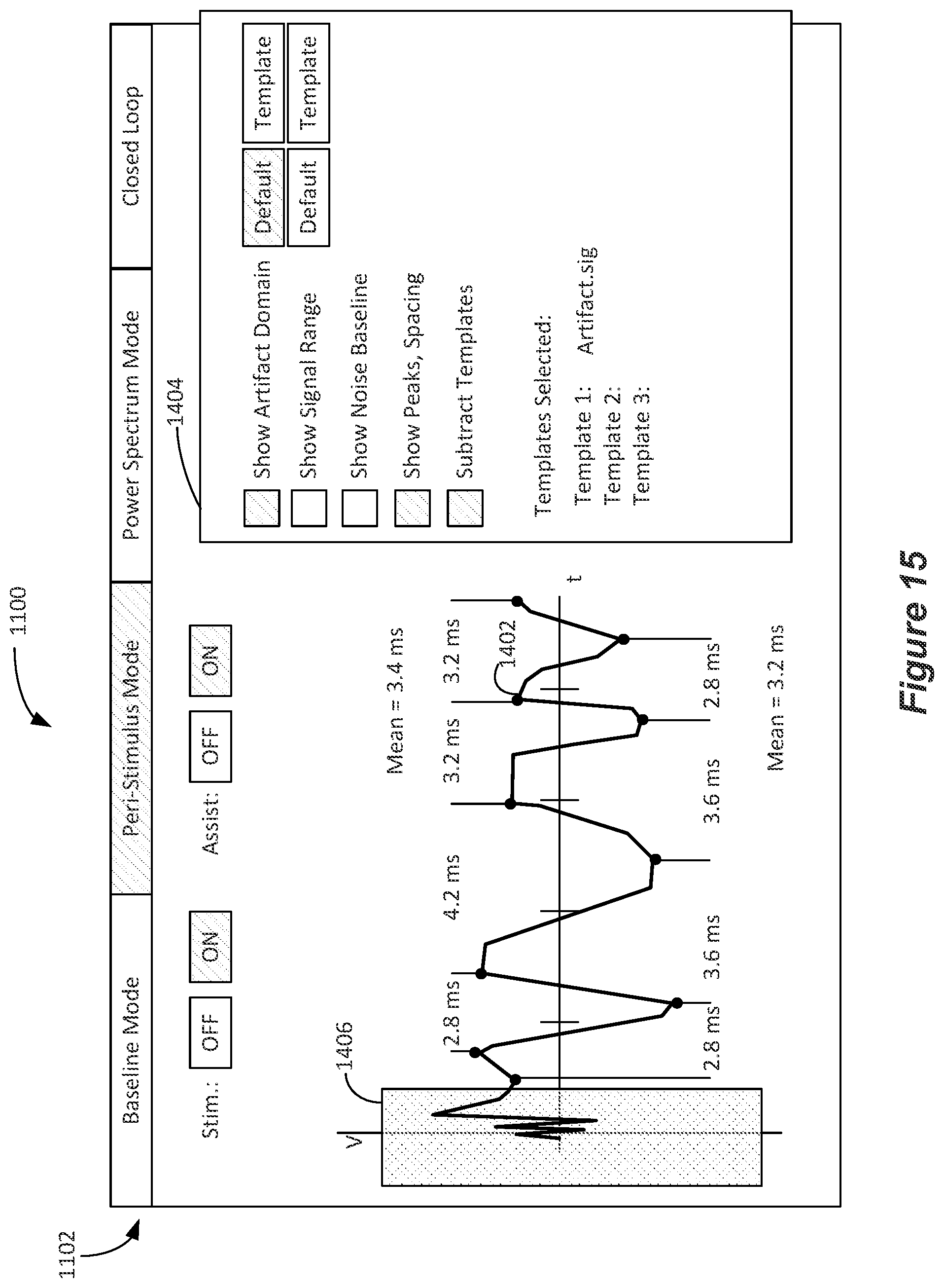 Patent US12324918 Figure 13 – Methods and systems for lead movement detection and response in DBS therapy