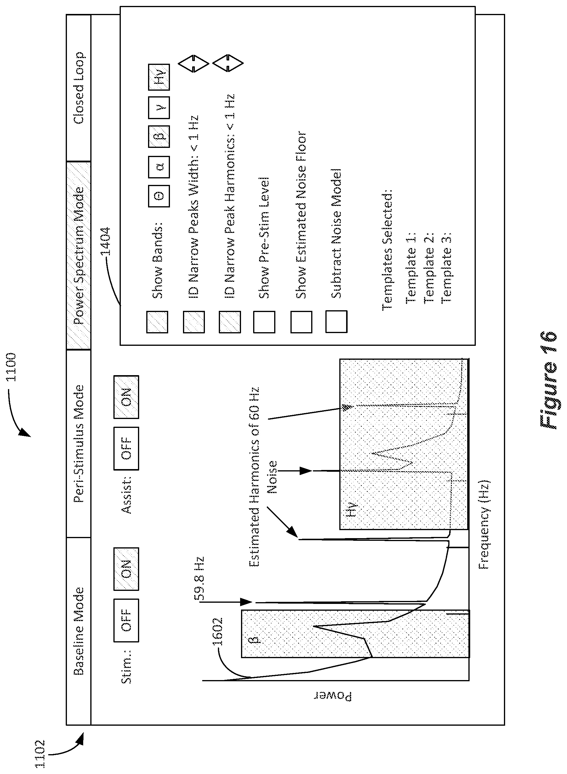 Patent US12324918 Figure 14 – Methods and systems for lead movement detection and response in DBS therapy