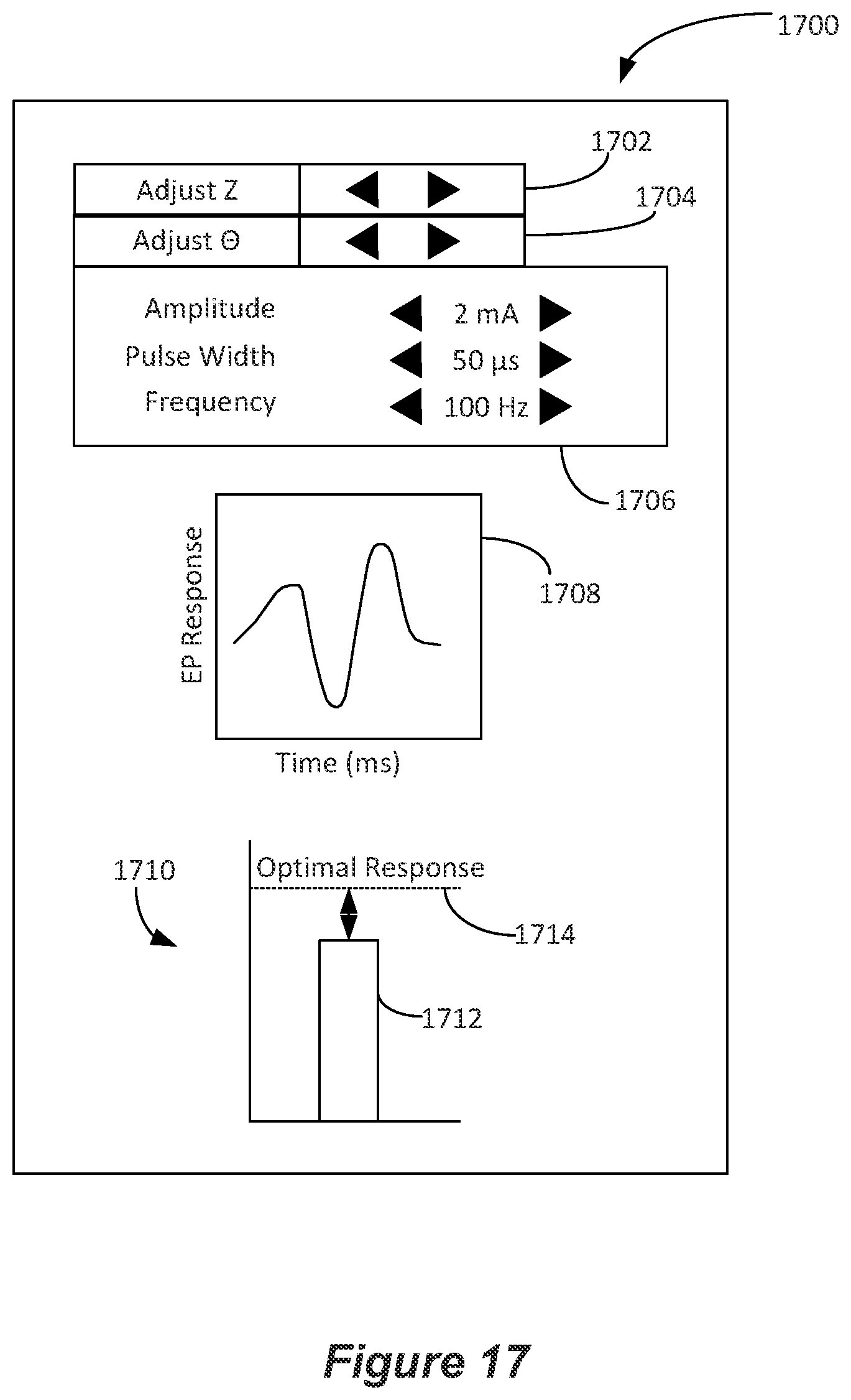 Patent US12324918 Figure 15 – Methods and systems for lead movement detection and response in DBS therapy