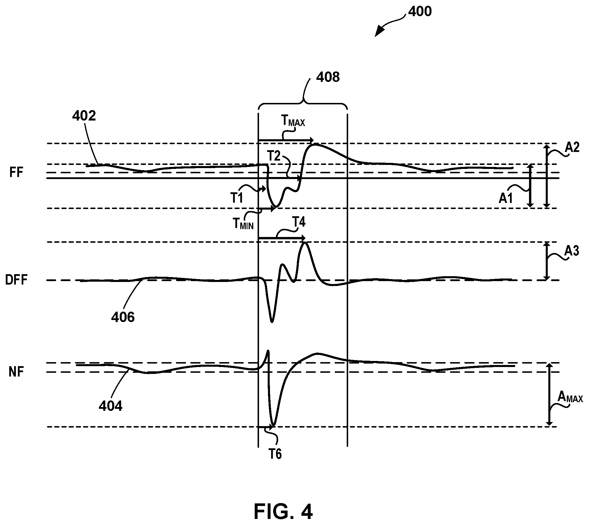 Patent US12324920 Figure 4 – Implantable medical device with pacing capture classification