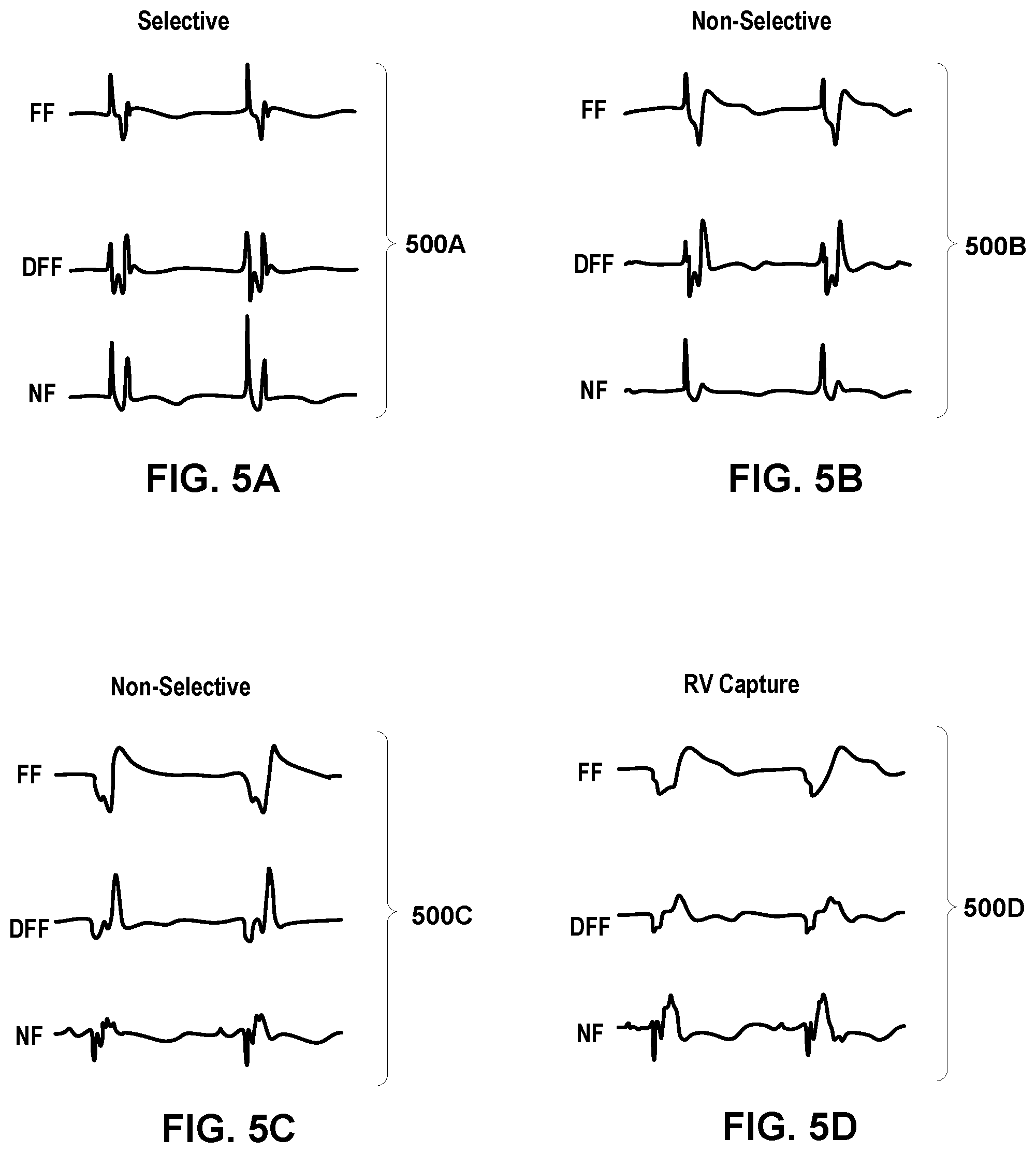 Patent US12324920 Figure 5 – Implantable medical device with pacing capture classification