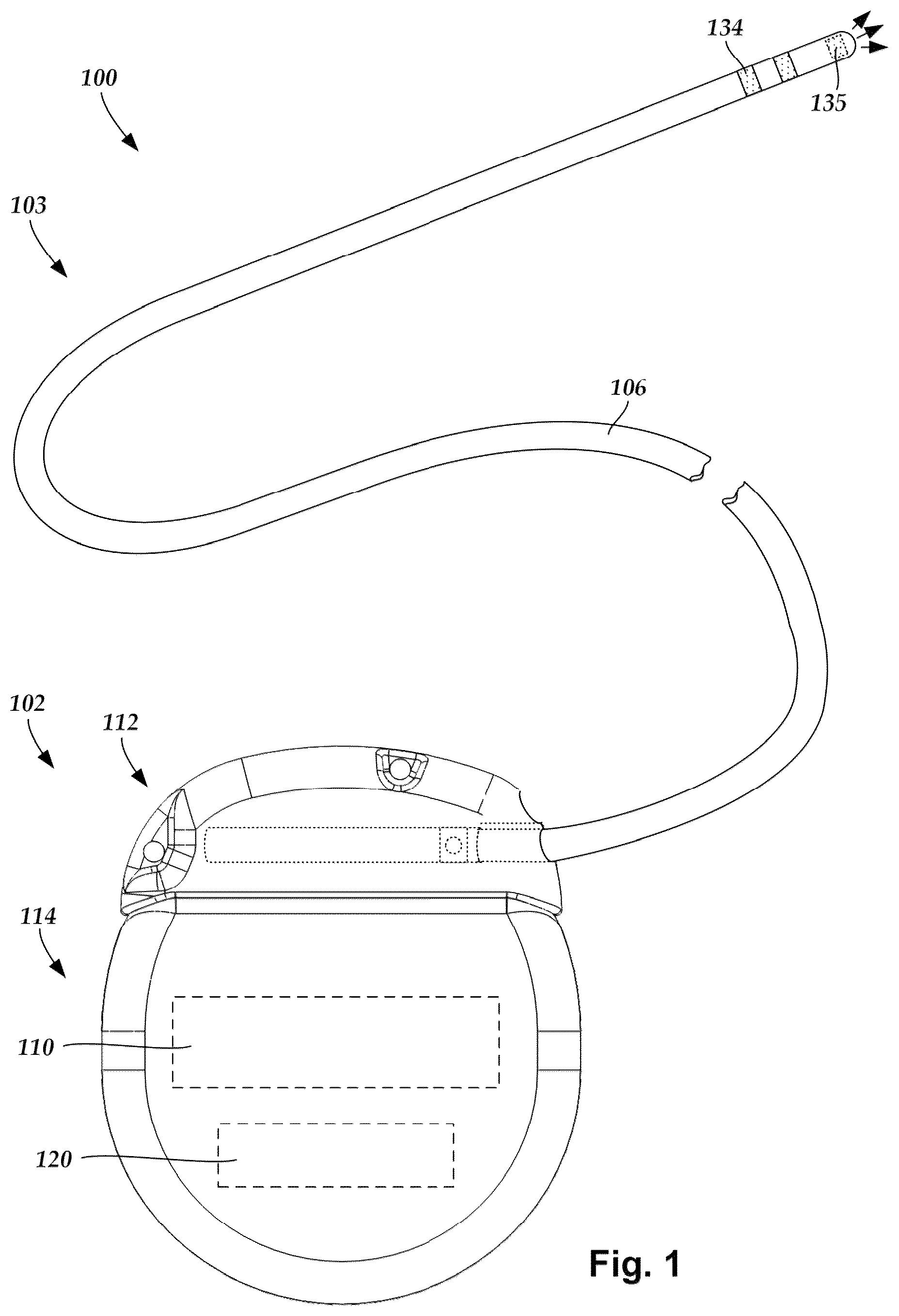 Patent US12324925 Figure 1 – Implantable optical stimulation lead and methods of making and using