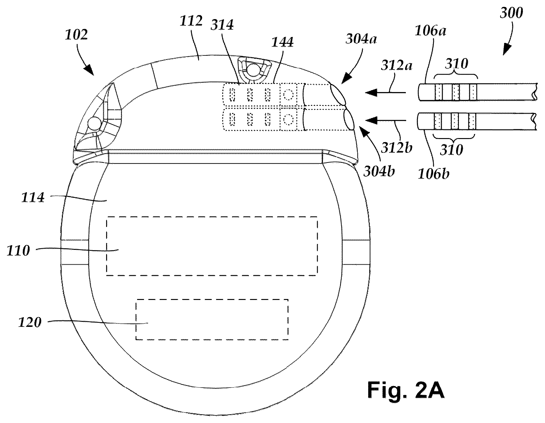 Patent US12324925 Figure 2 – Implantable optical stimulation lead and methods of making and using